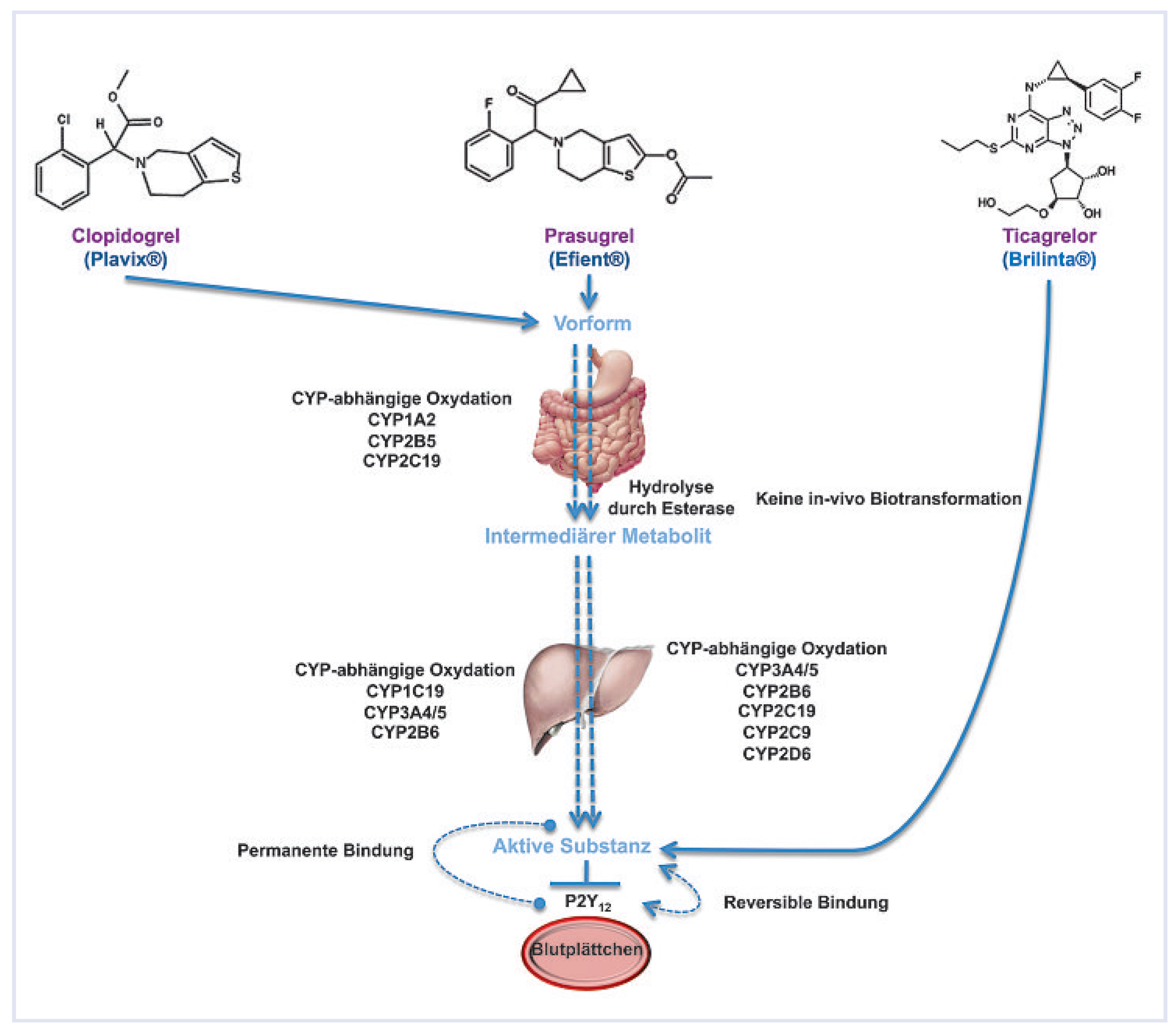 Cardiovascmed 13 00060 g003