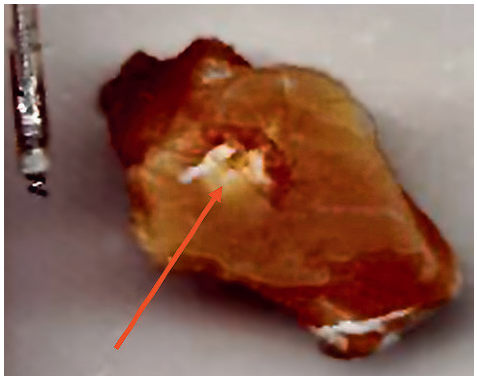 Cardiovascmed 13 00070 g001