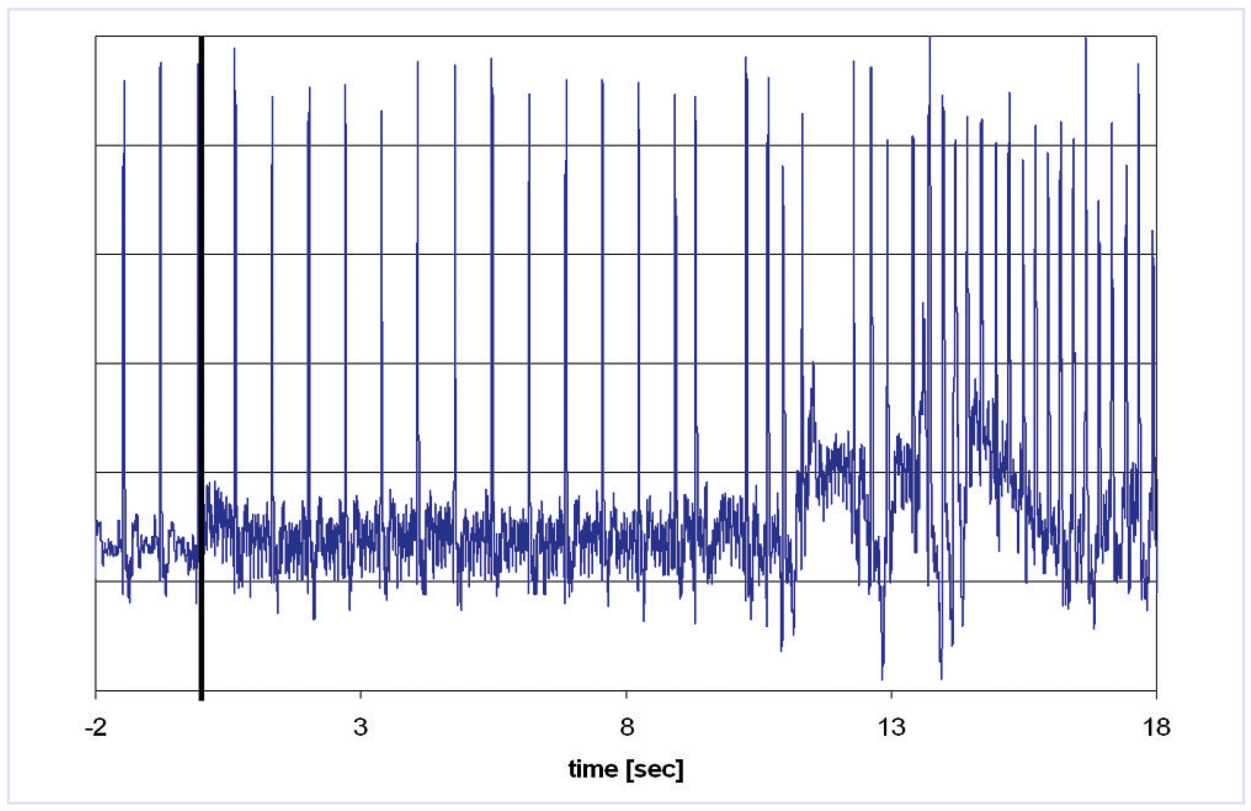 Cardiovascmed 13 00070 g002