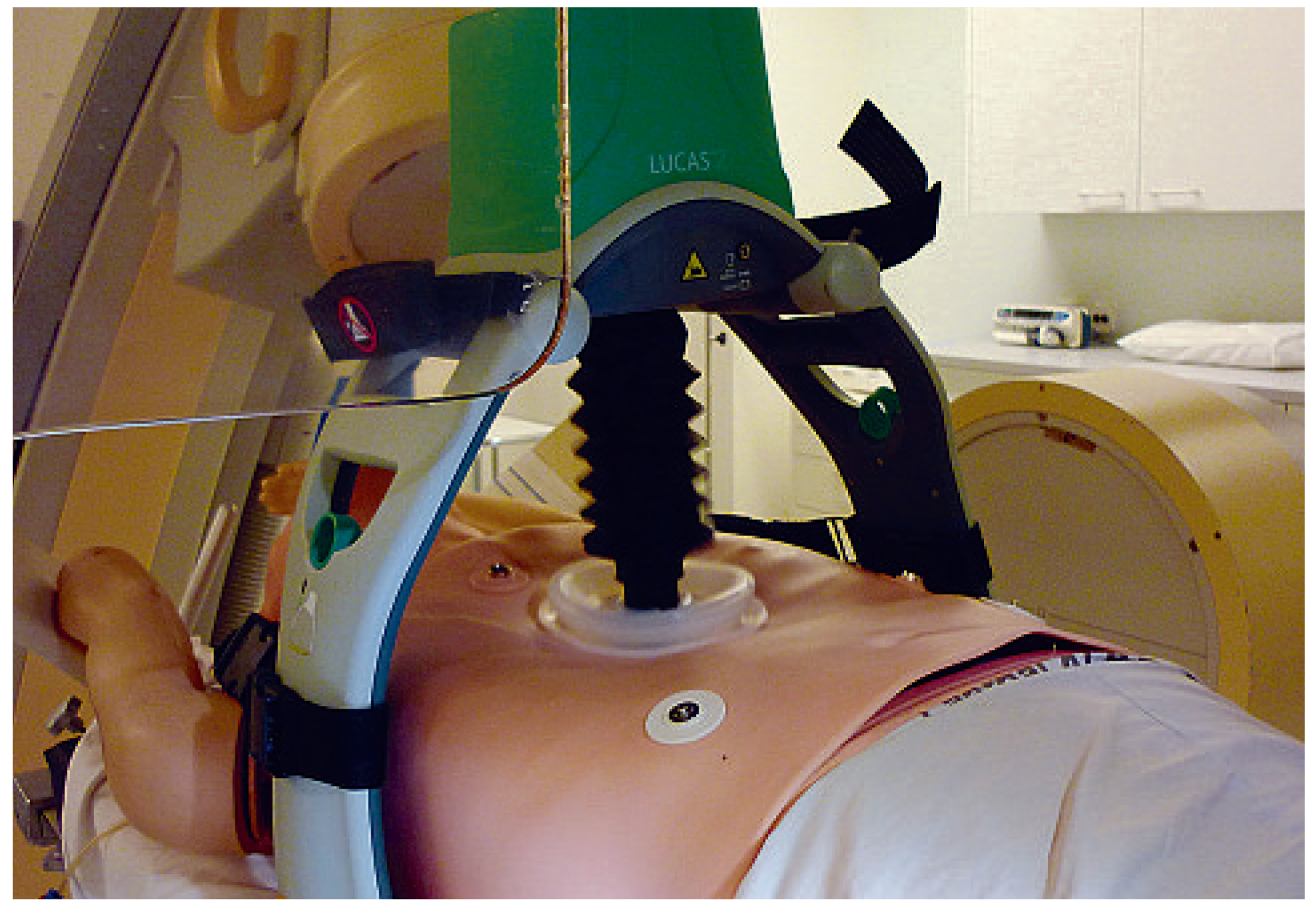 Cardiovascmed 13 00092 g002