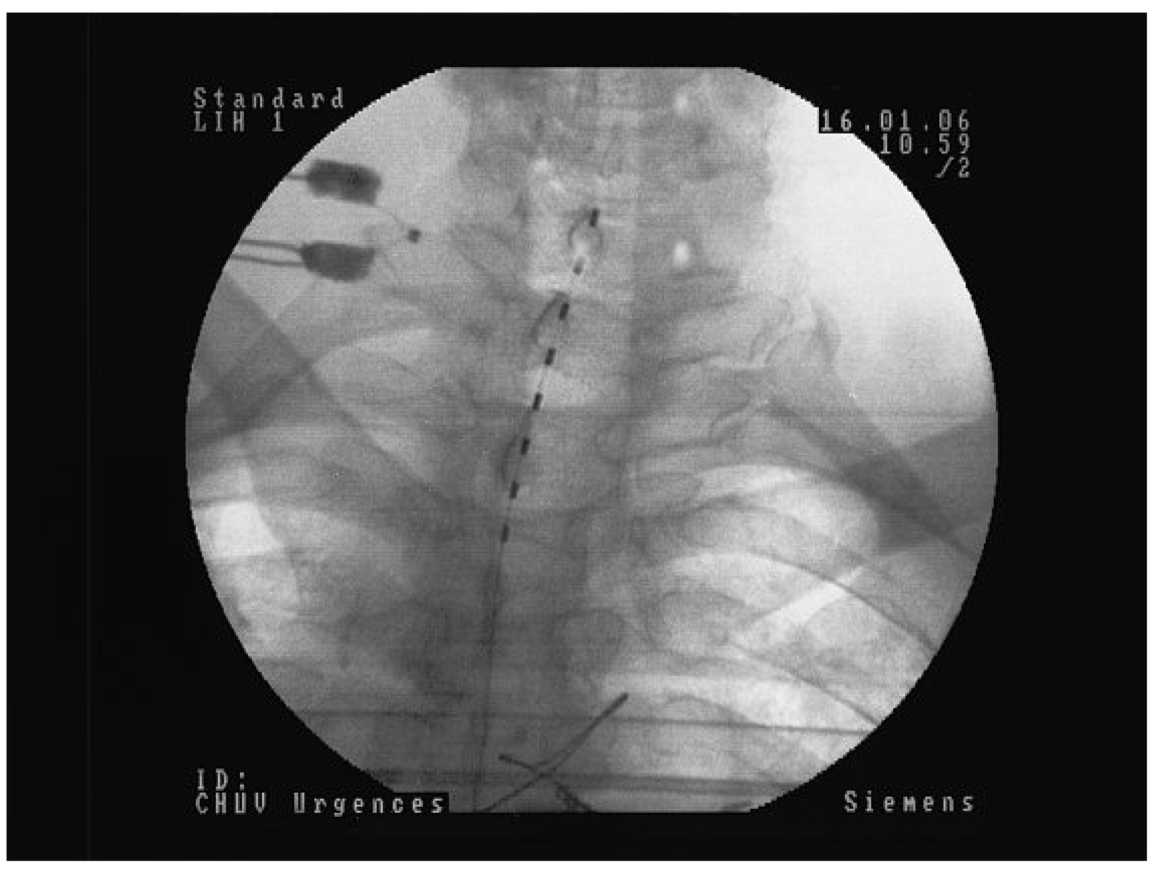 Cardiovascmed 13 00097 g002 Cardiovascmed 13 00097 g002