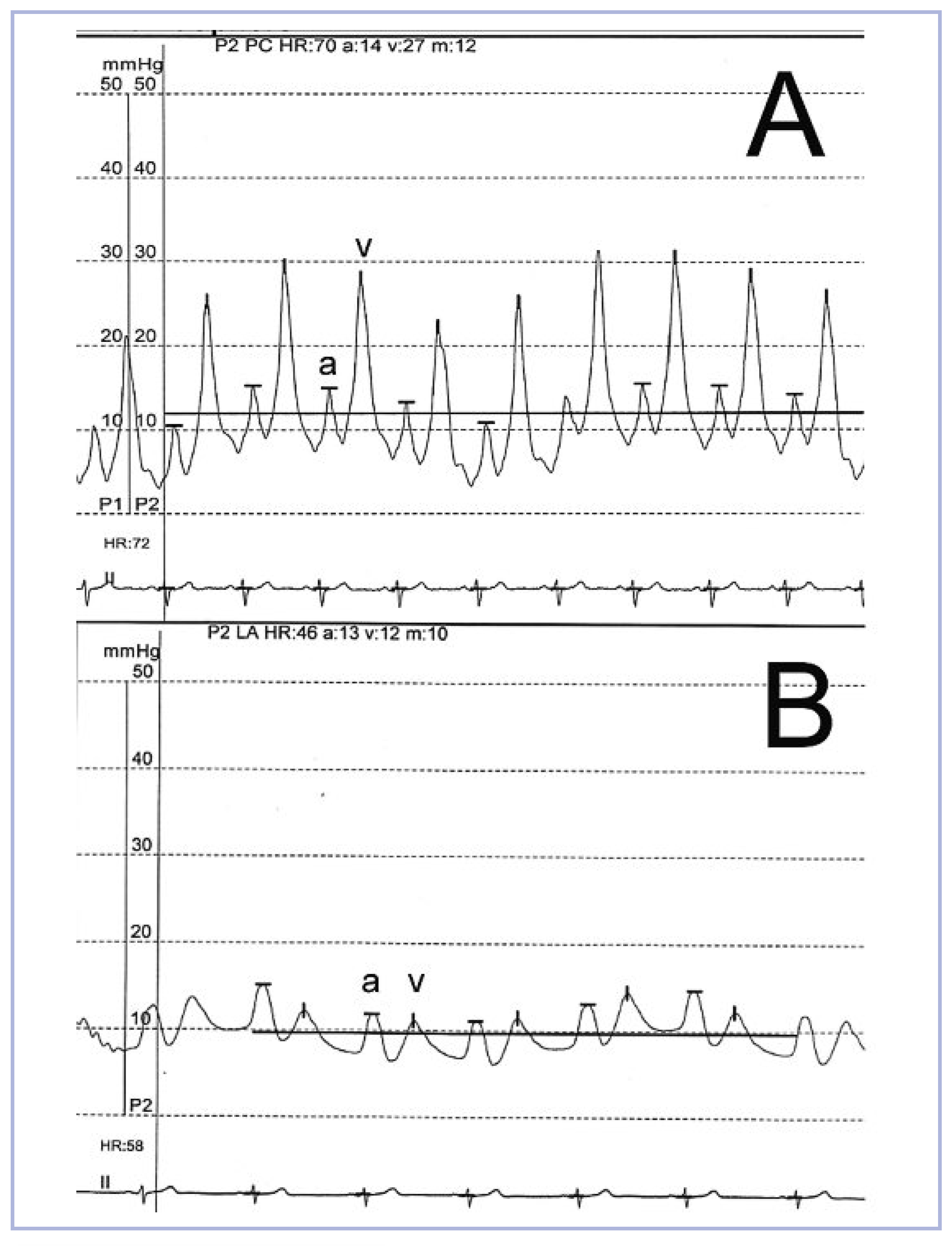 Cardiovascmed 13 00104 g001