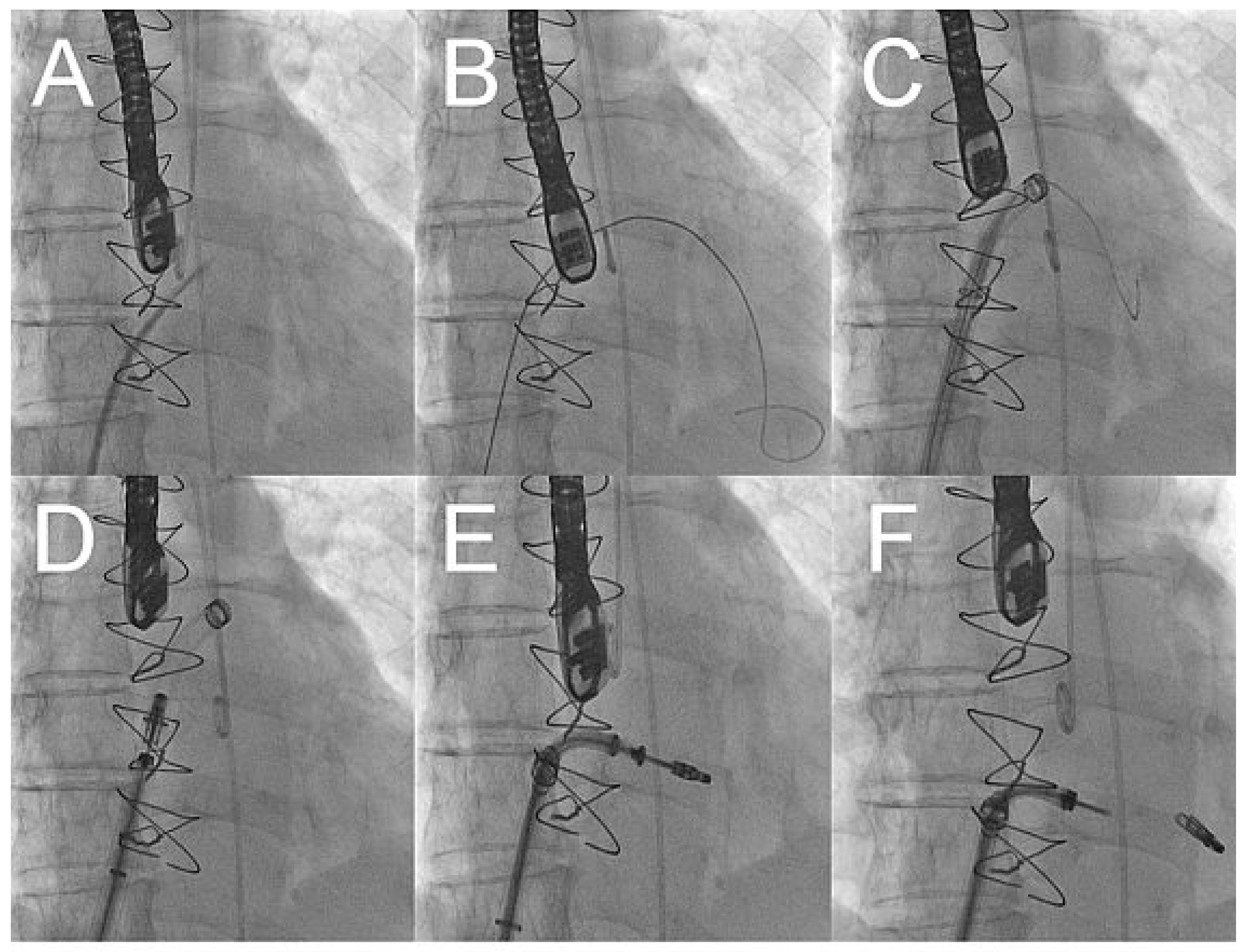 Cardiovascmed 13 00104 g003