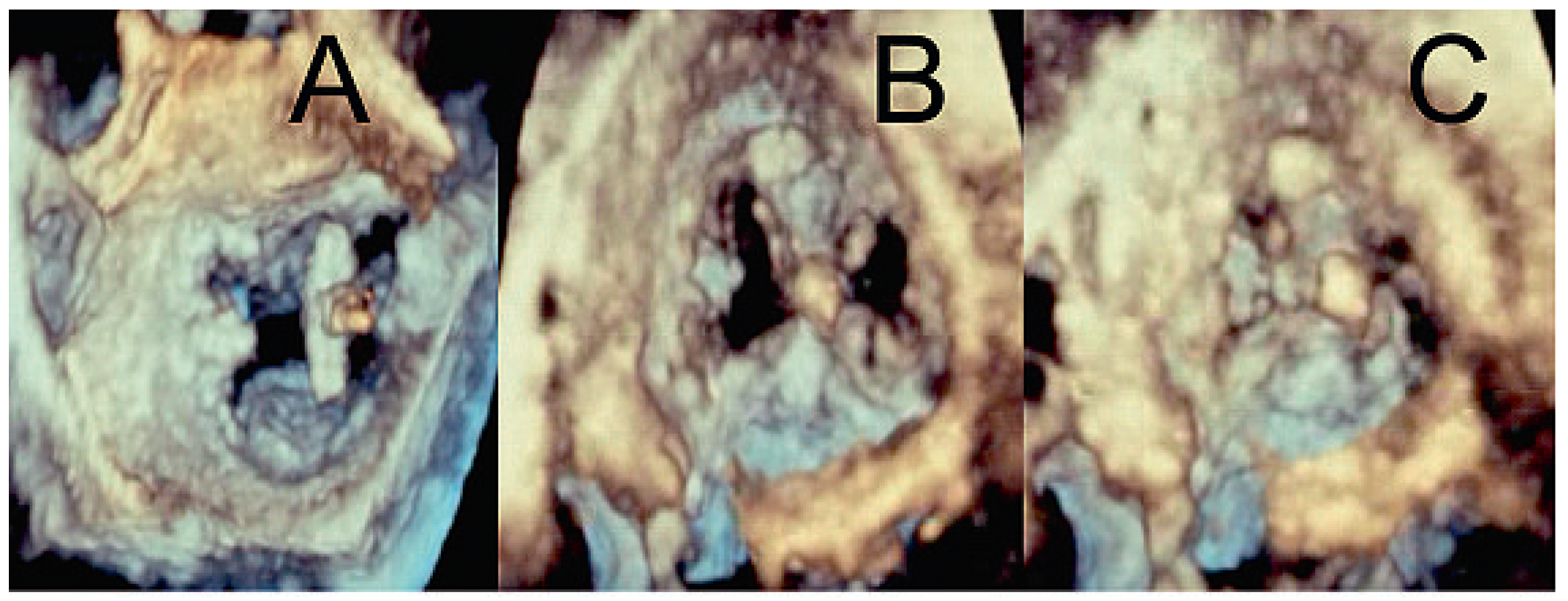 Cardiovascmed 13 00104 g005