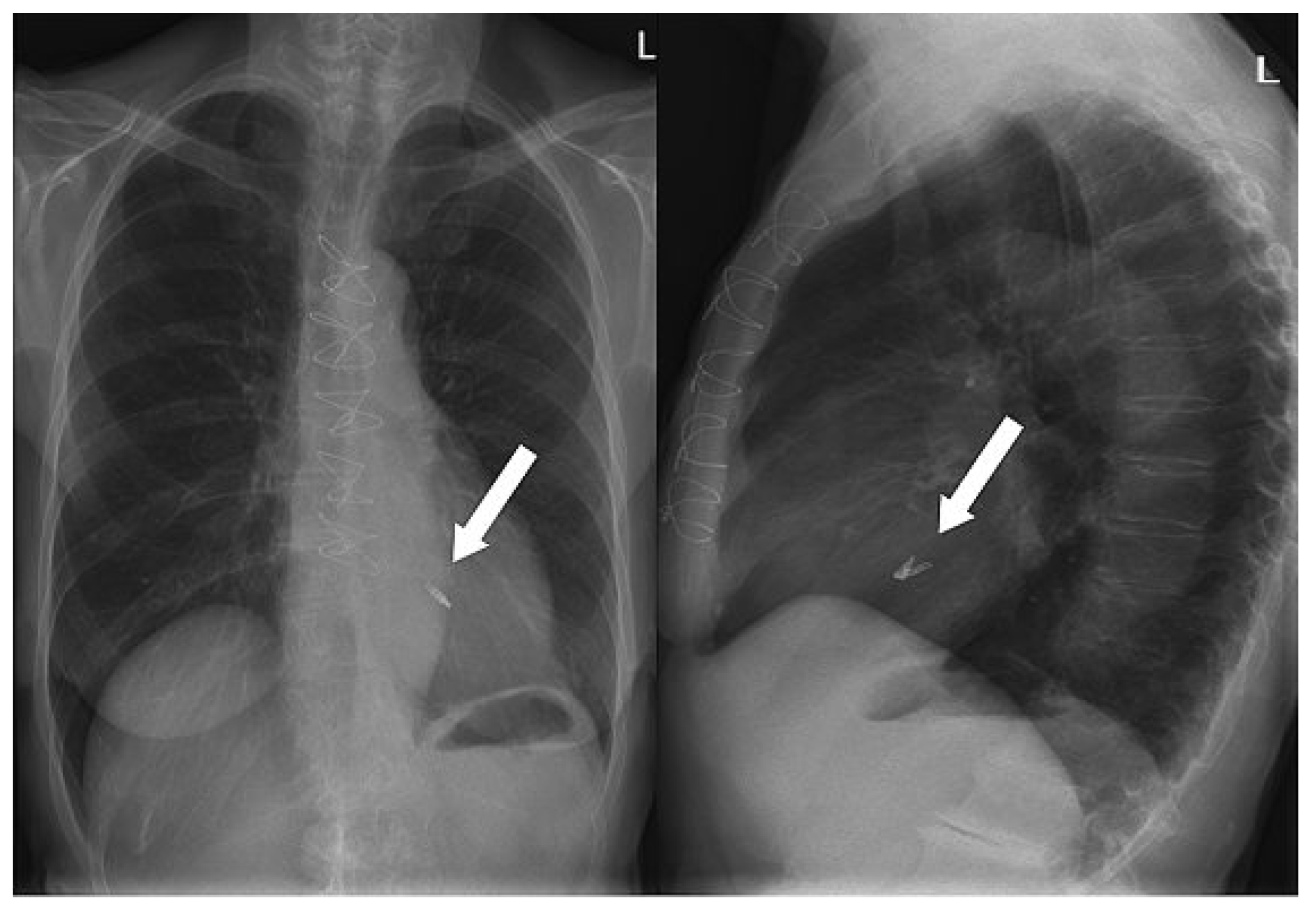Cardiovascmed 13 00104 g006