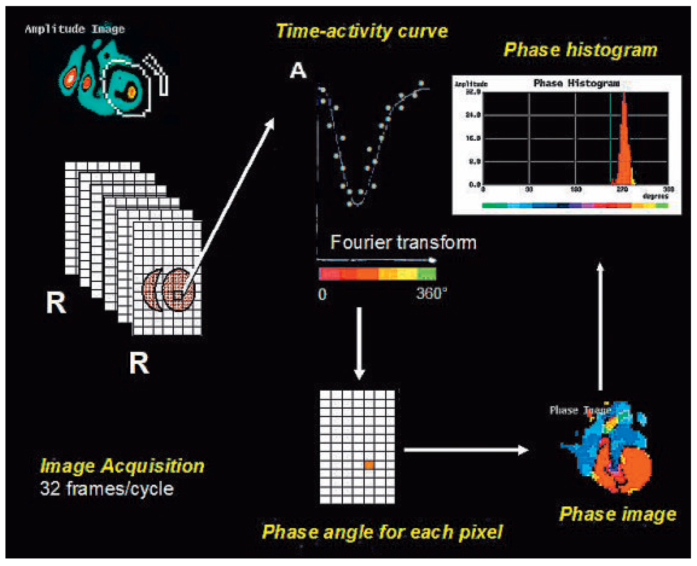 Cardiovascmed 13 00115 g001 Cardiovascmed 13 00115 g001