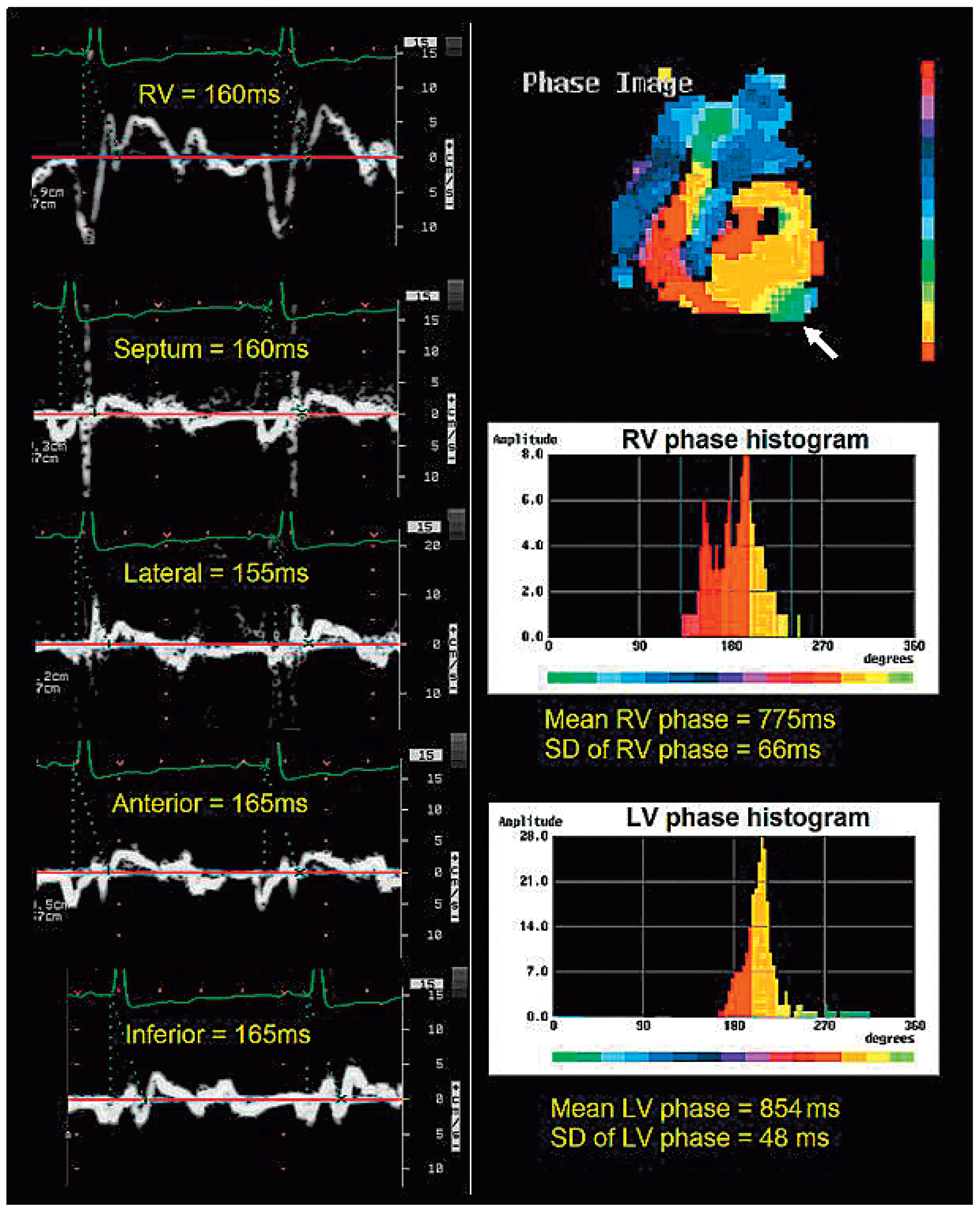 Cardiovascmed 13 00115 g003 Cardiovascmed 13 00115 g003