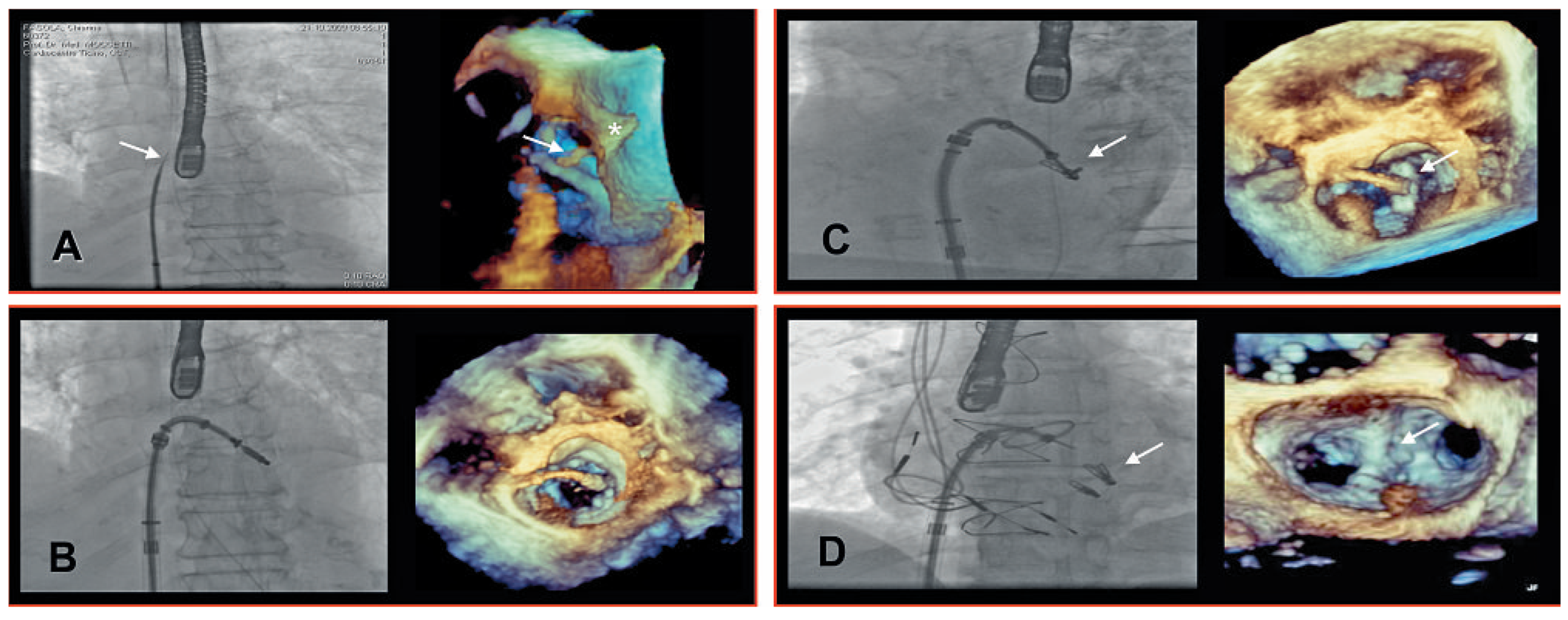 Cardiovascmed 13 00122 g002