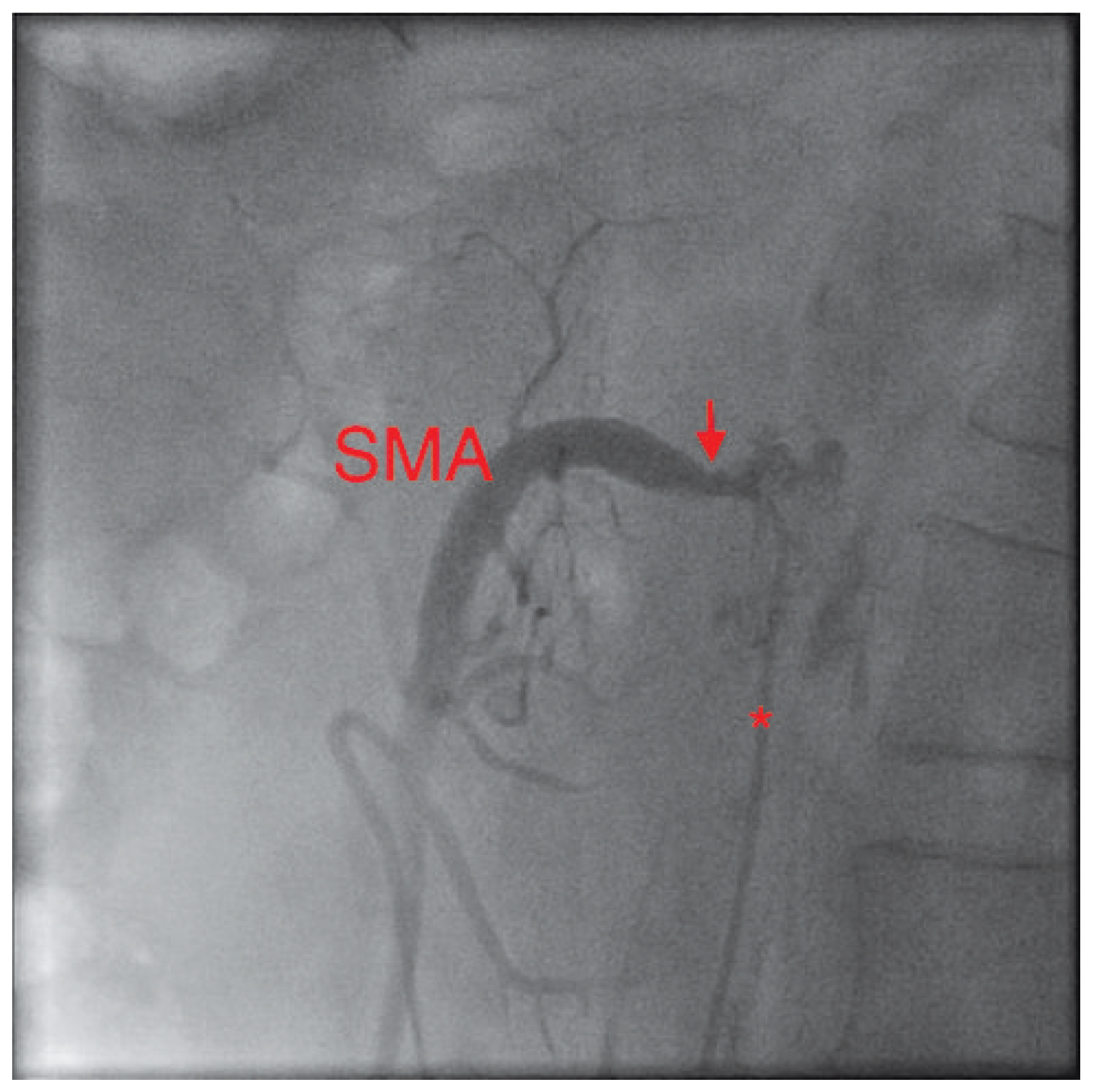 Cardiovascmed 13 00135 g001