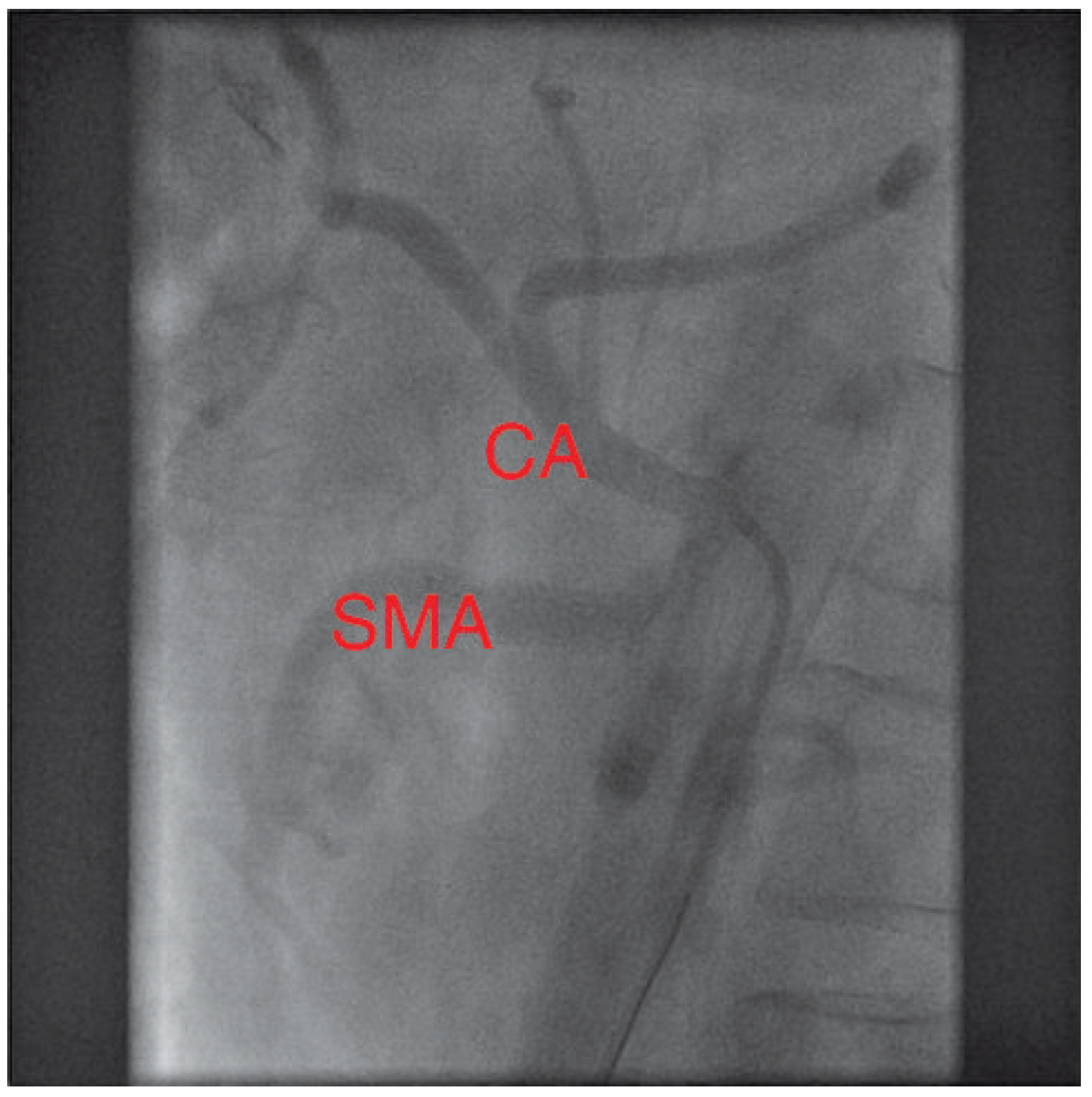 Cardiovascmed 13 00135 g004