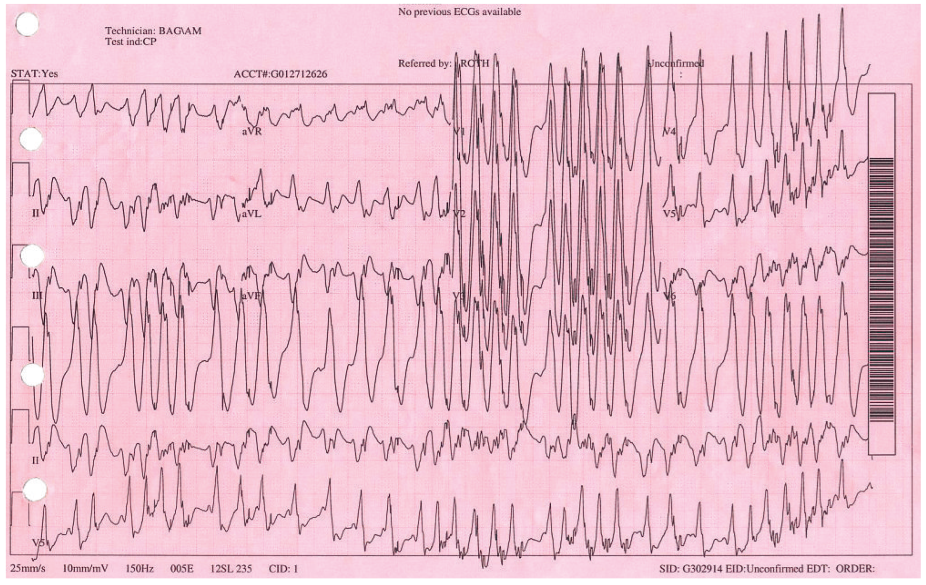 Cardiovascmed 13 00138 g001