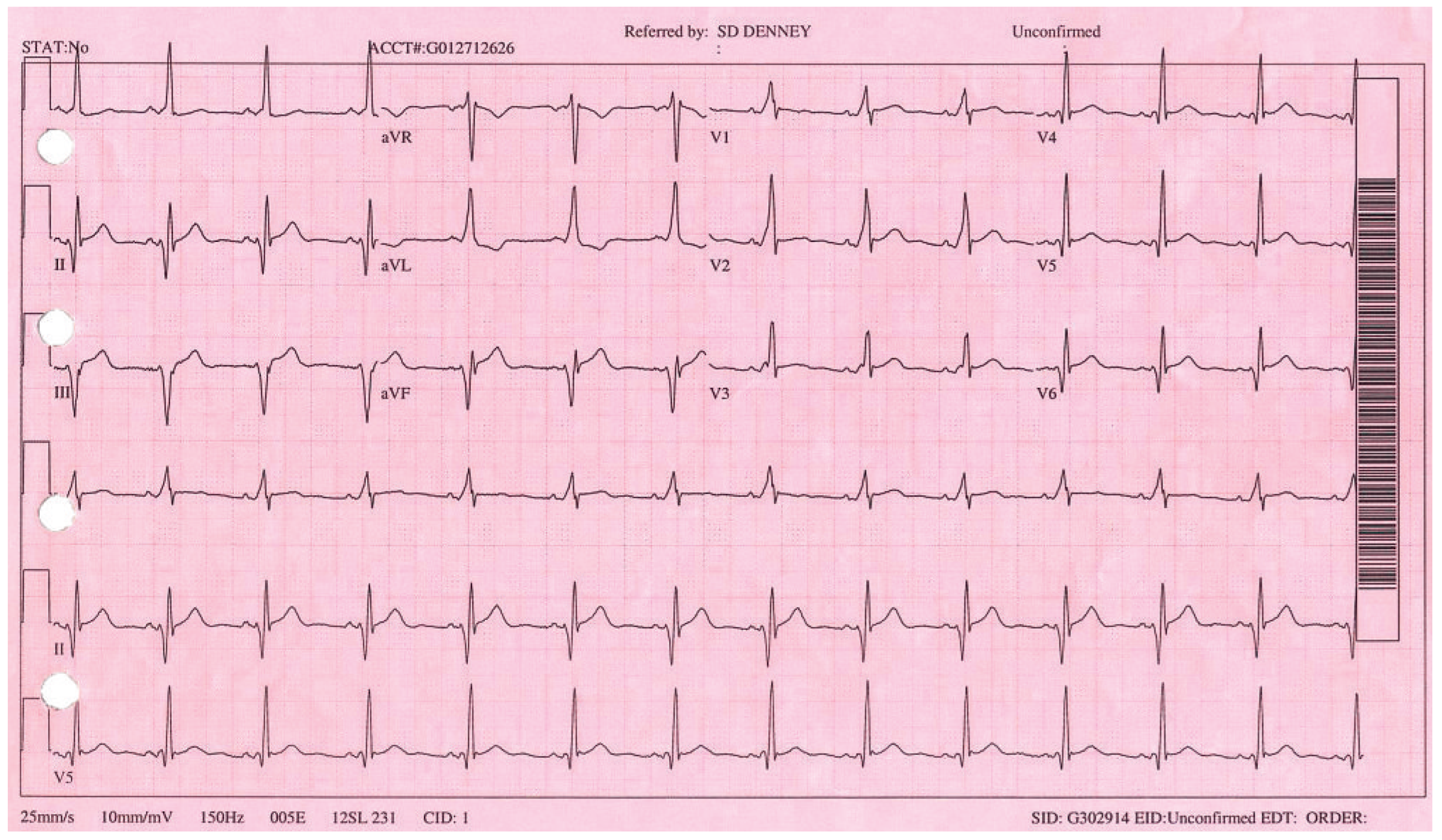 Cardiovascmed 13 00138 g003