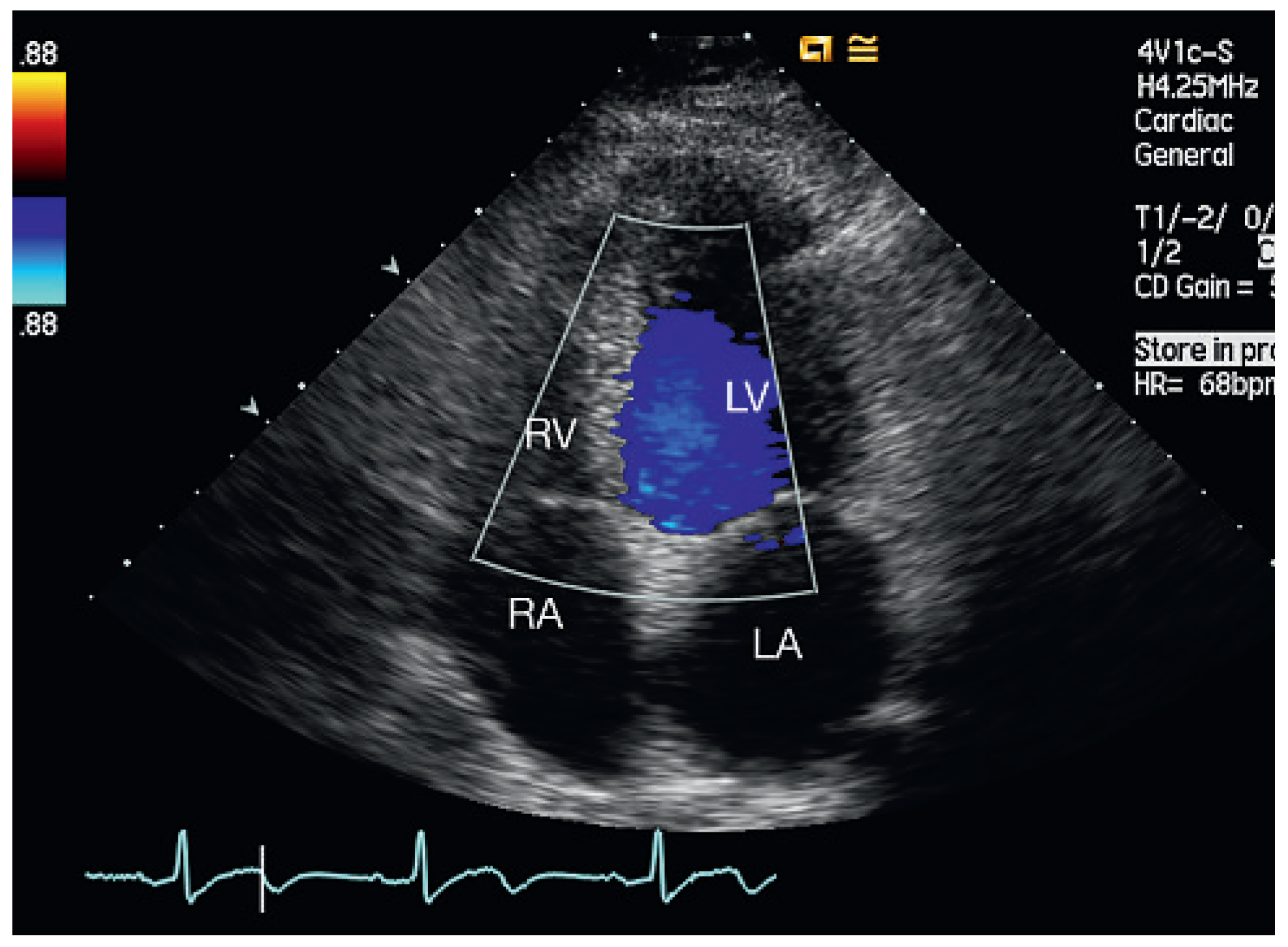 Cardiovascmed 13 00167 g002