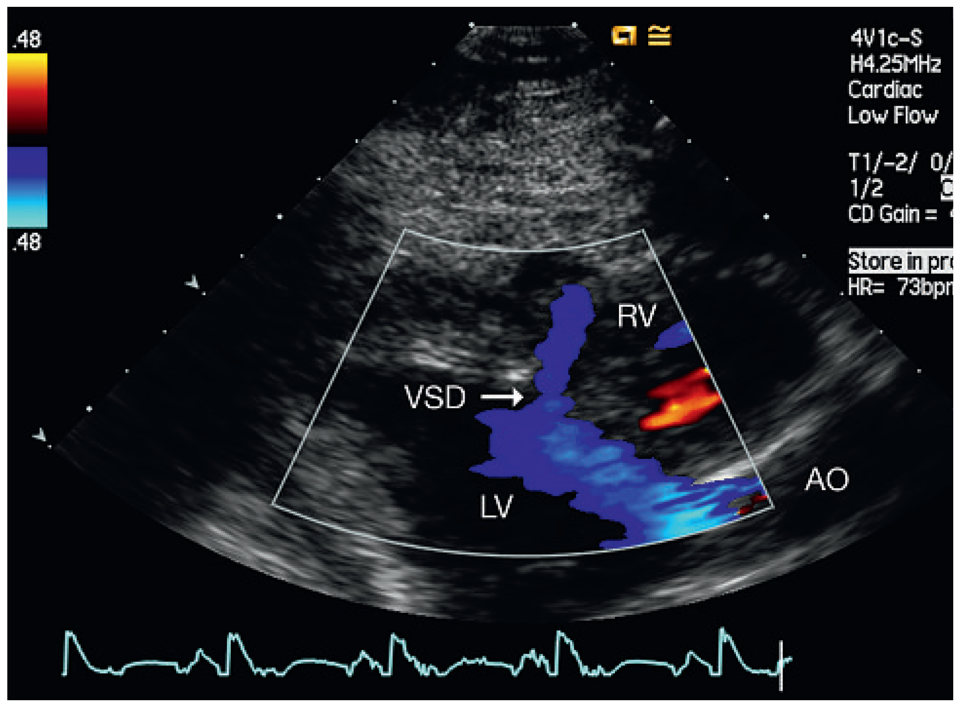 Cardiovascmed 13 00167 g006