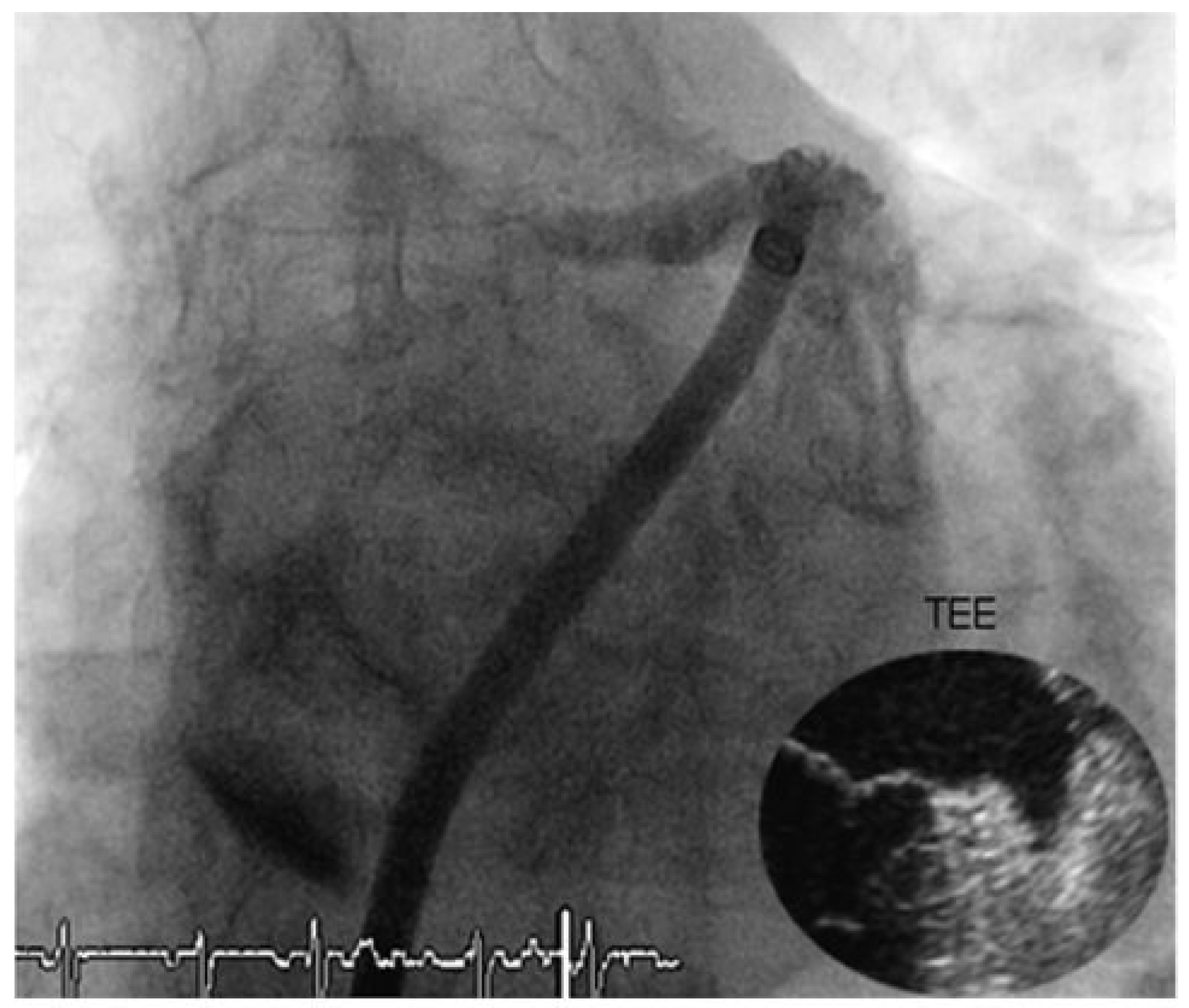 Cardiovascmed 13 00171 g001