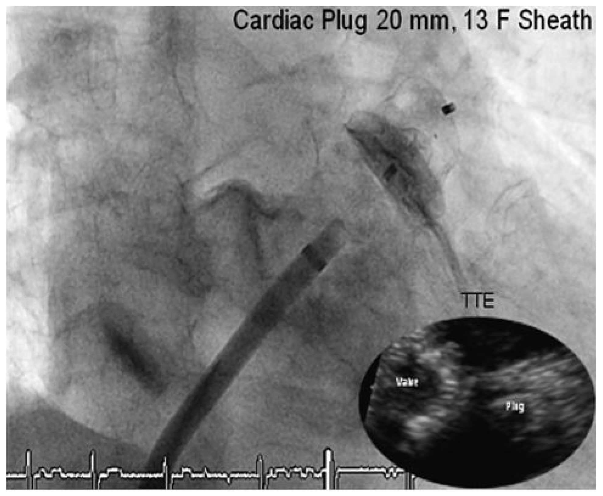 Cardiovascmed 13 00171 g002