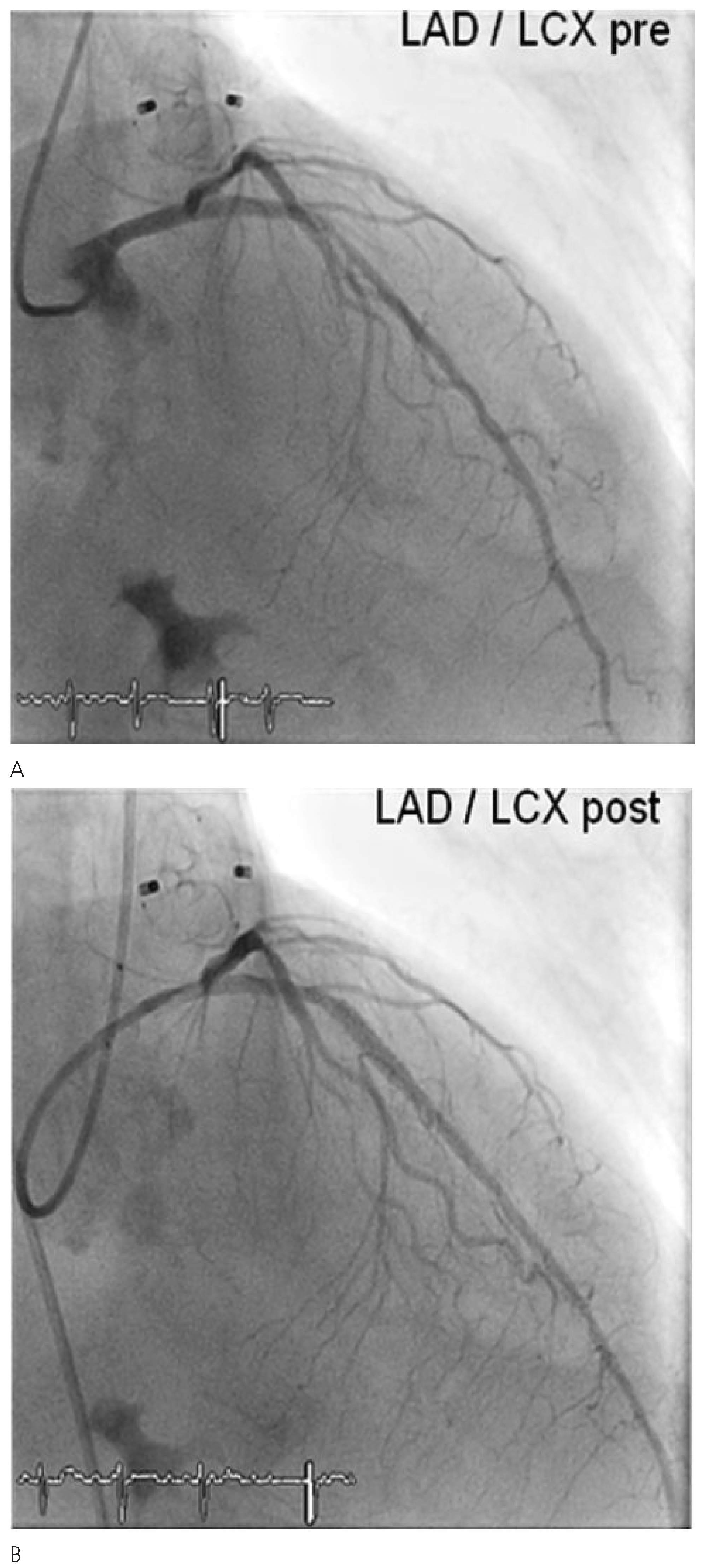 Cardiovascmed 13 00171 g003