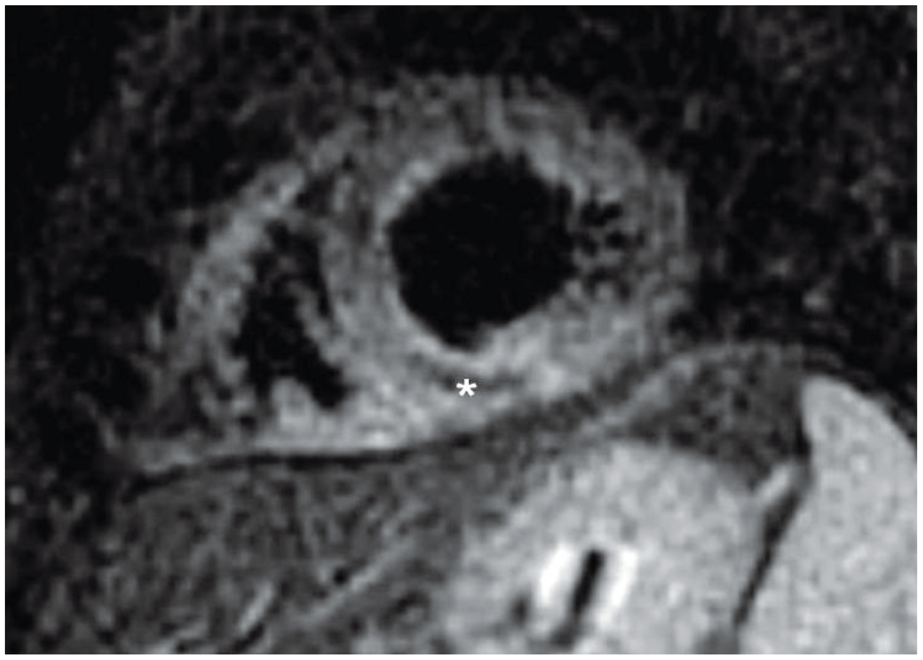 Cardiovascmed 13 00174 g001