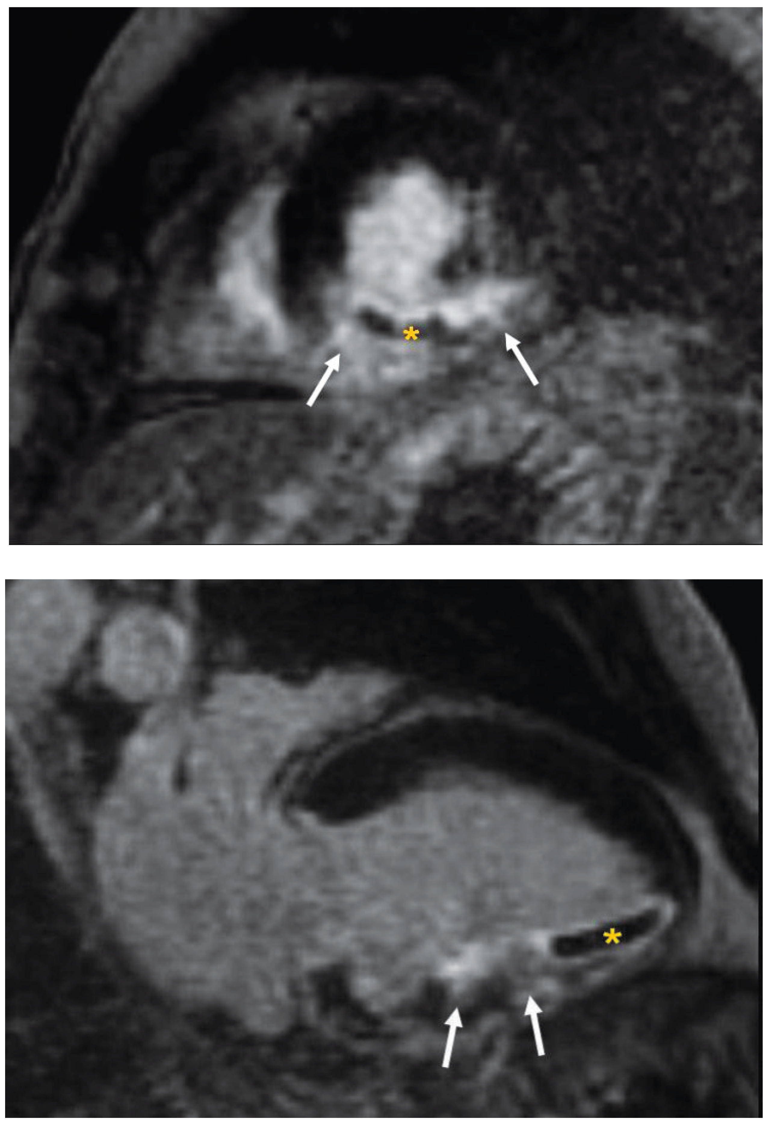 Cardiovascmed 13 00174 g002