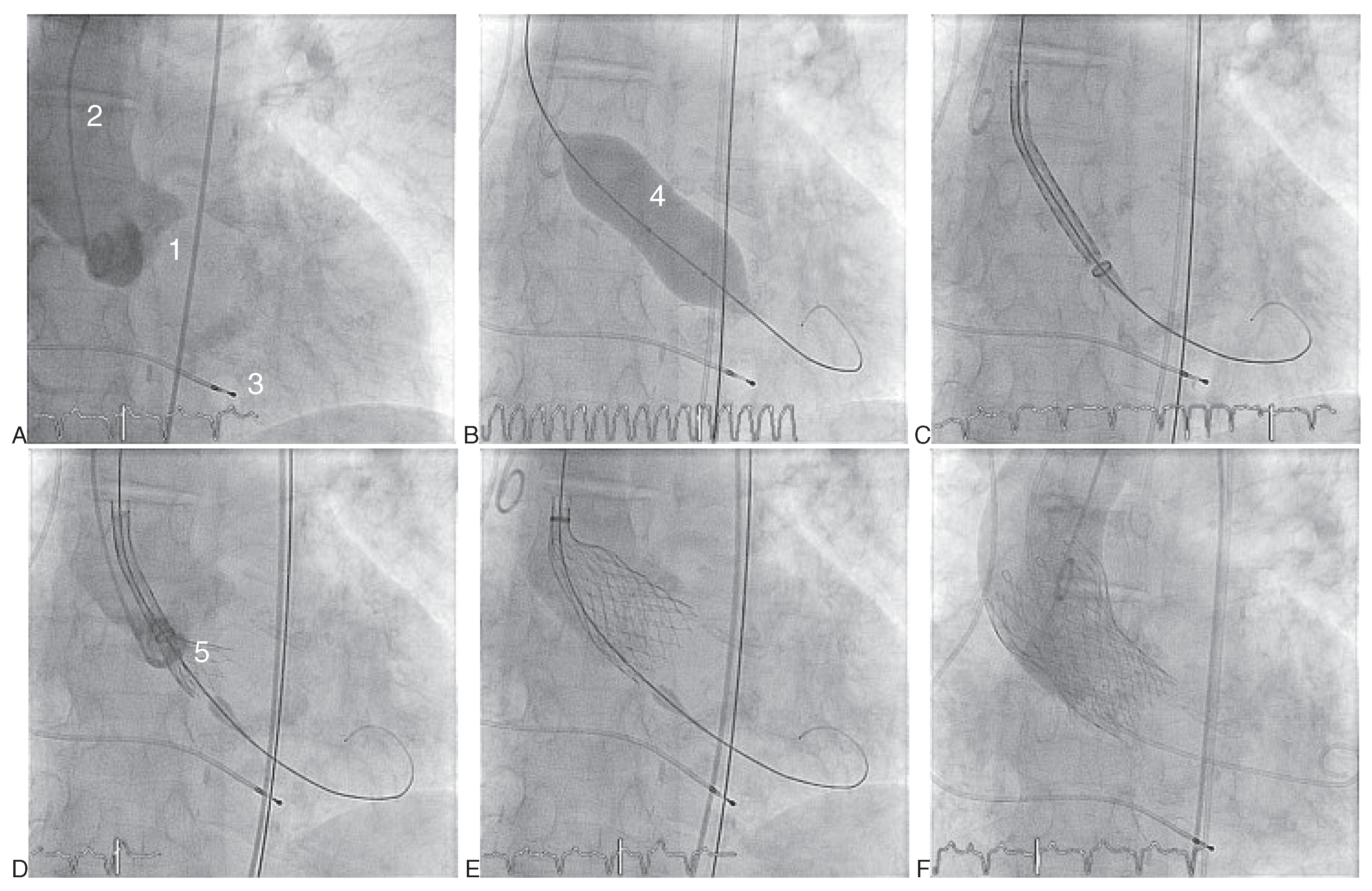 Cardiovascmed 13 00197 g004 Cardiovascmed 13 00197 g004