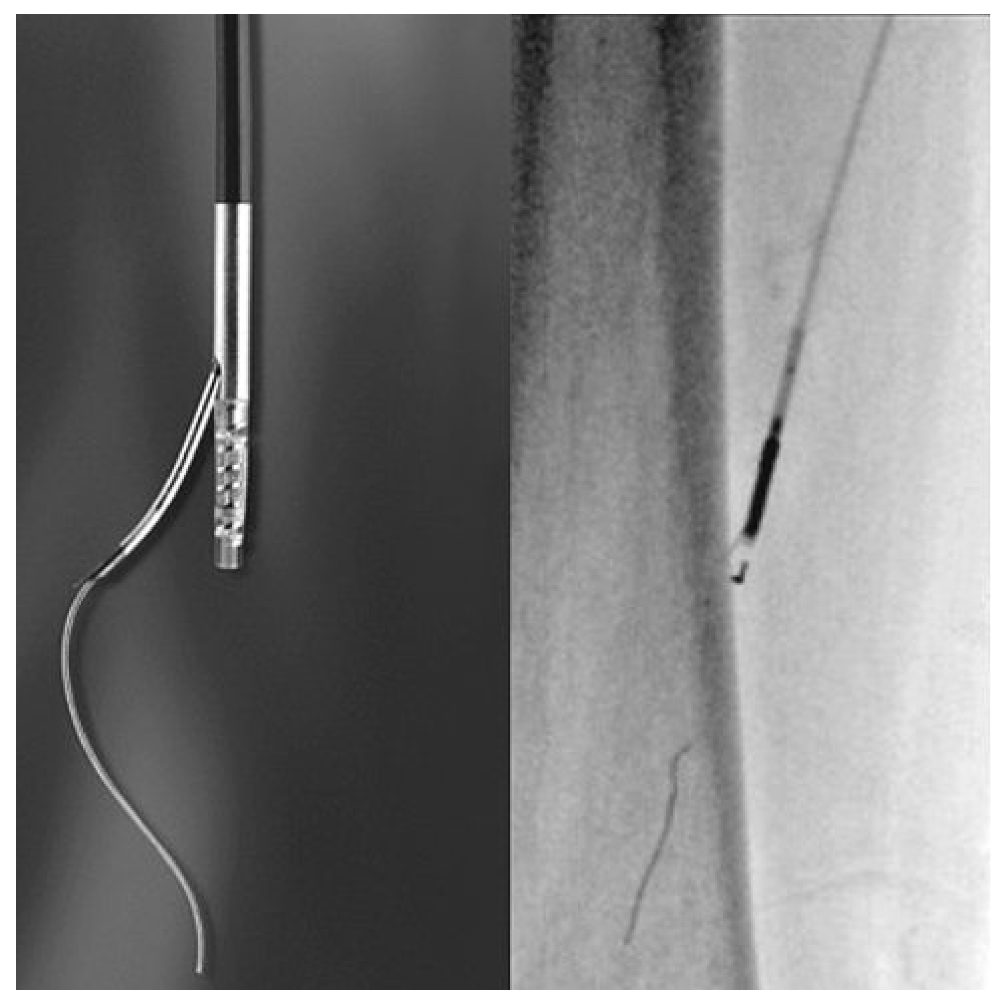 Cardiovascmed 13 00221 g002