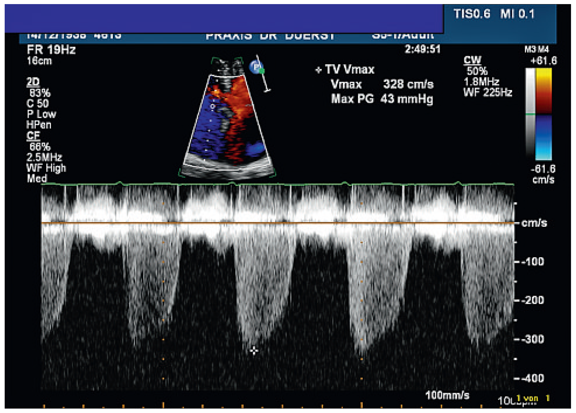 Cardiovascmed 13 00240 g001