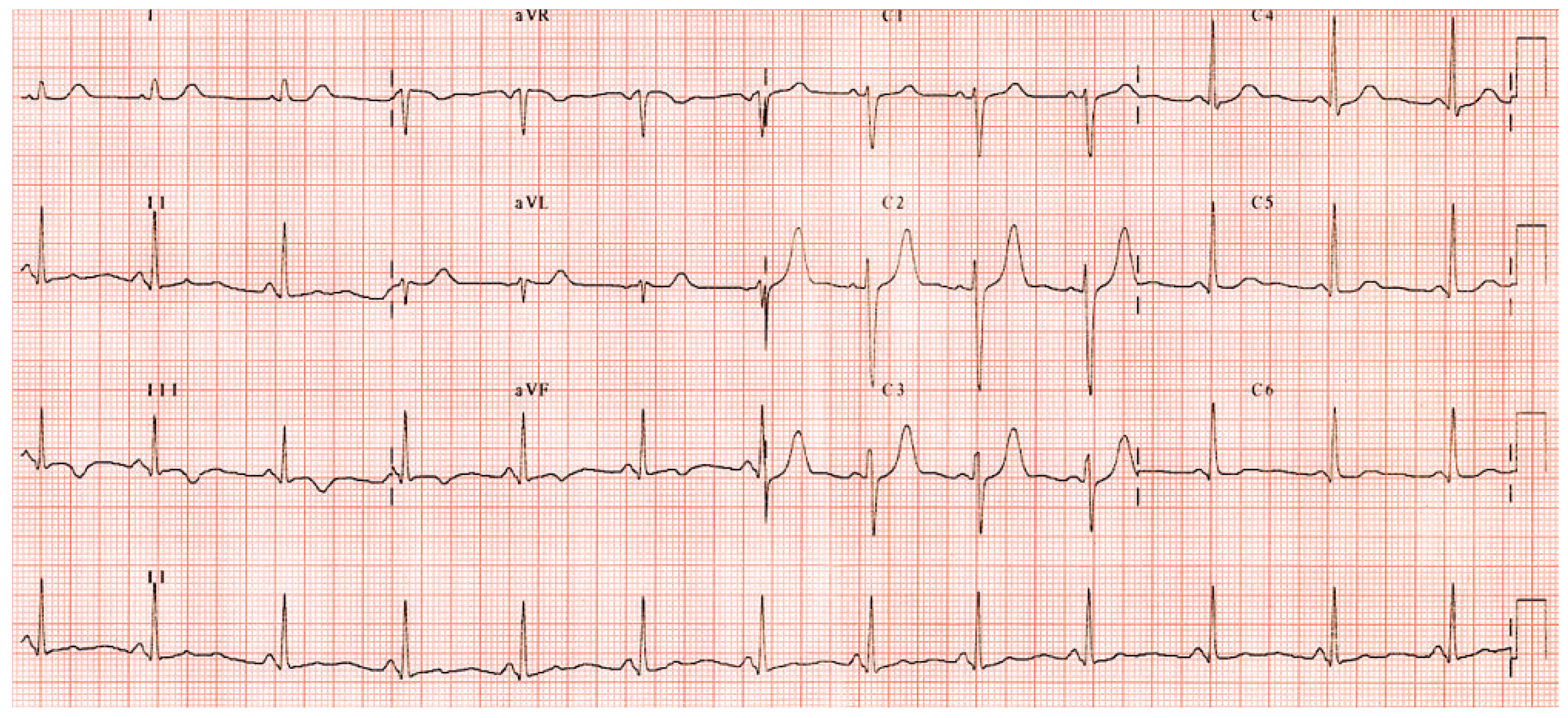 Cardiovascmed 13 00243 g002