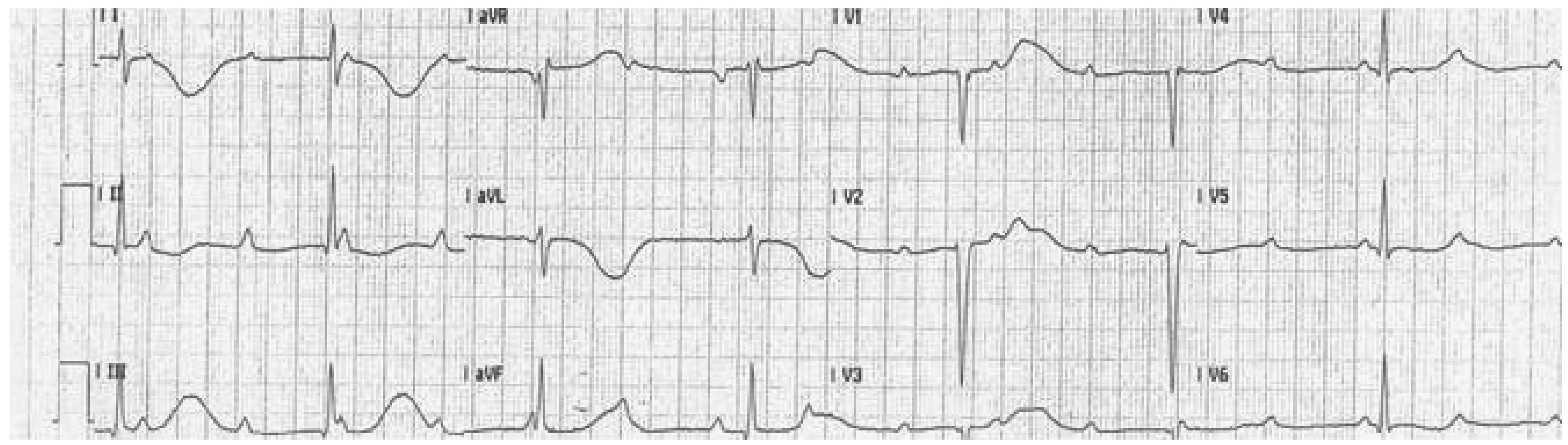Cardiovascmed 13 00245 g001 Cardiovascmed 13 00245 g001