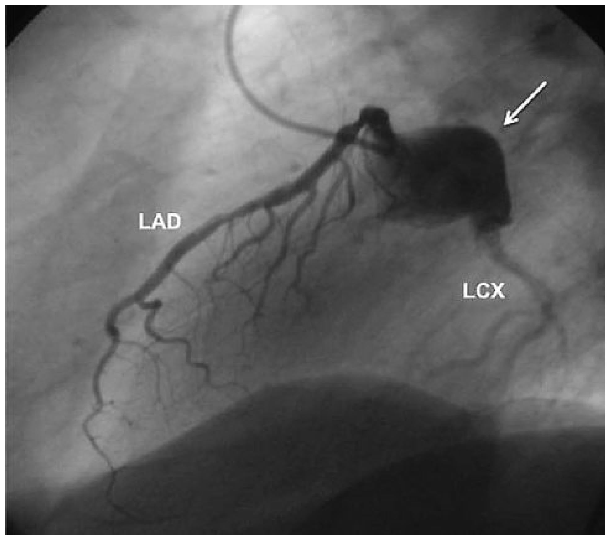 Cardiovascmed 13 00247 g001