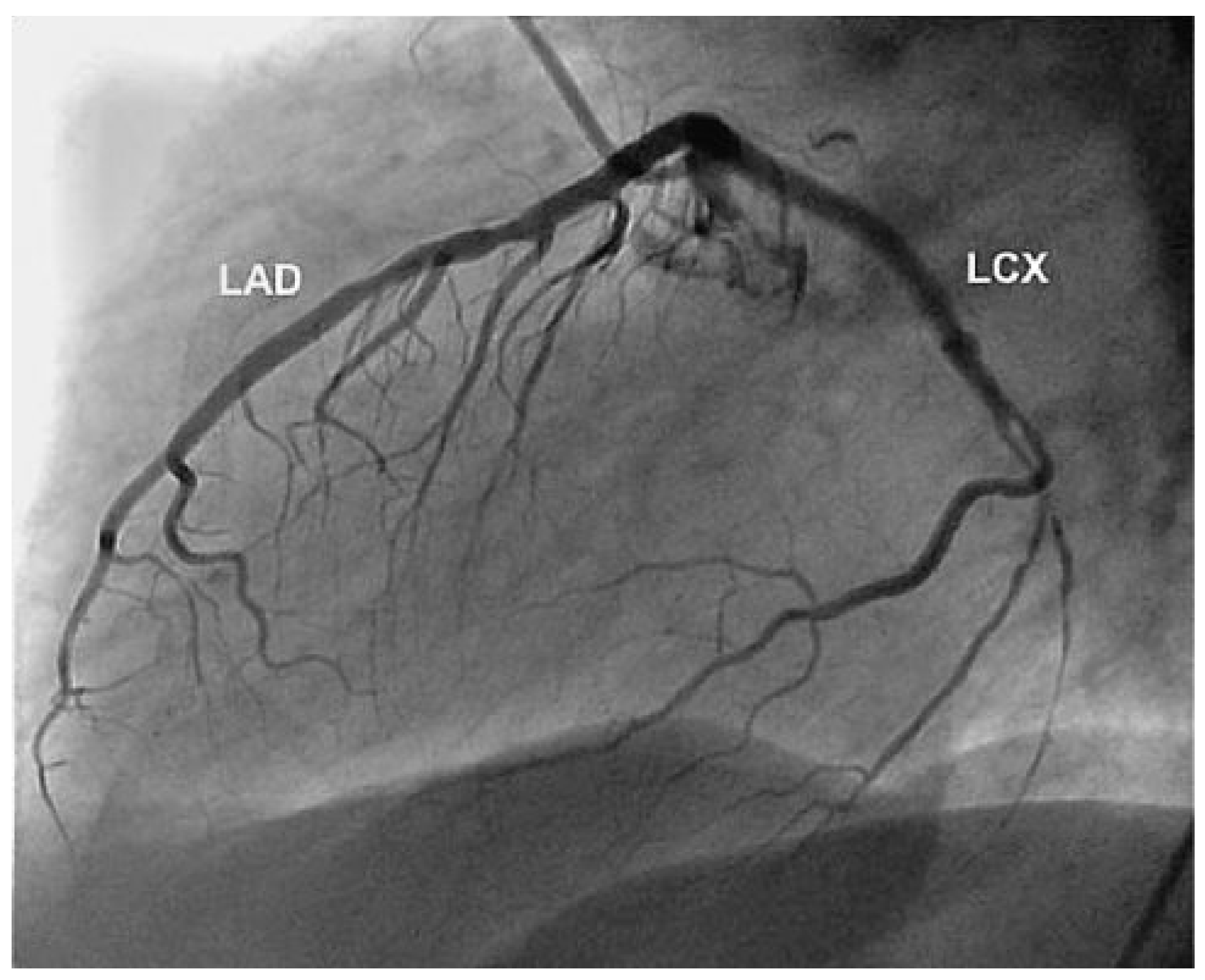 Cardiovascmed 13 00247 g004