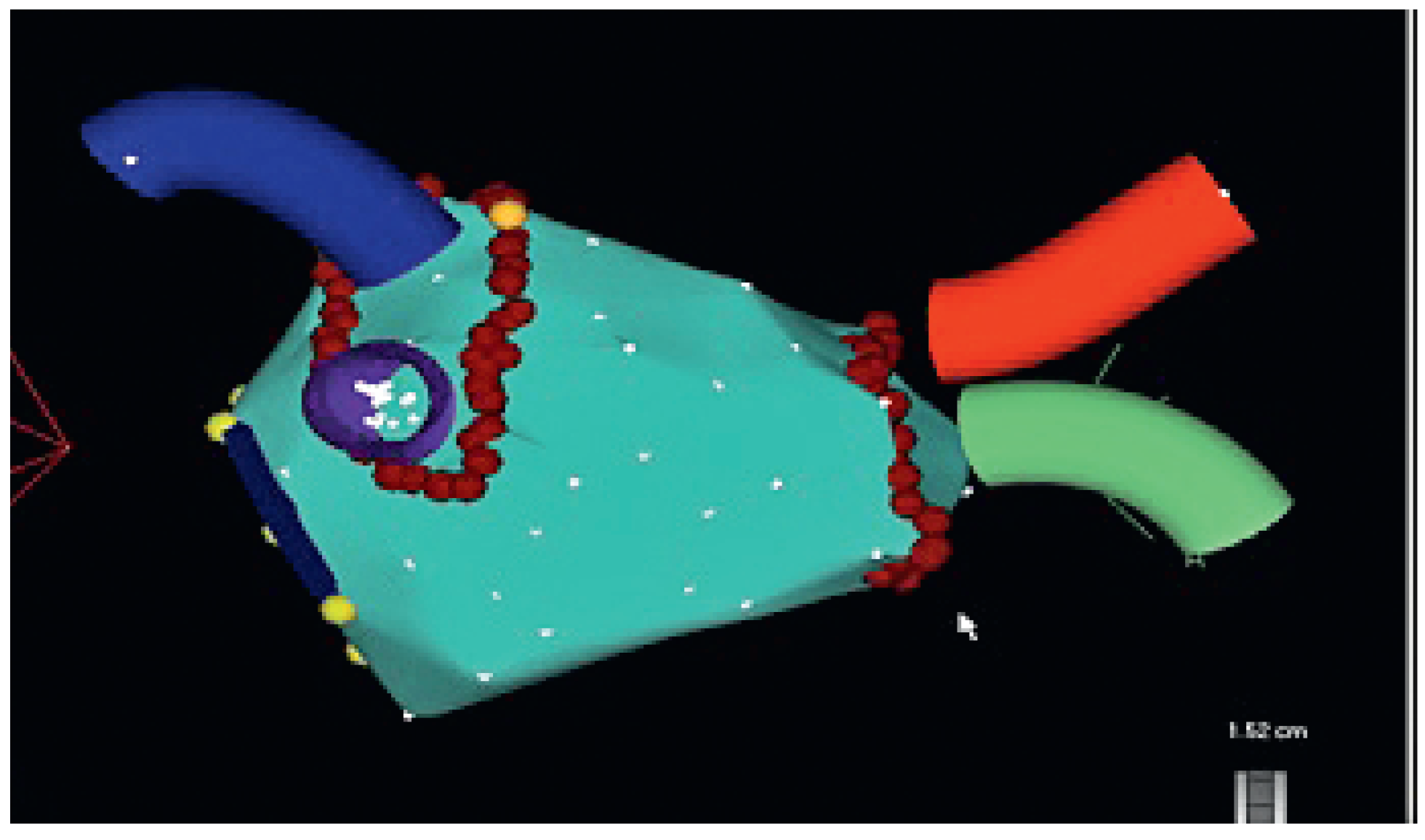 Cardiovascmed 13 00272 g005 Cardiovascmed 13 00272 g005