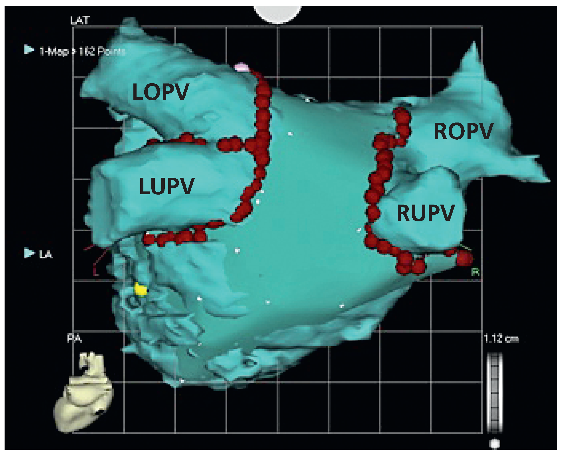 Cardiovascmed 13 00272 g007 Cardiovascmed 13 00272 g007