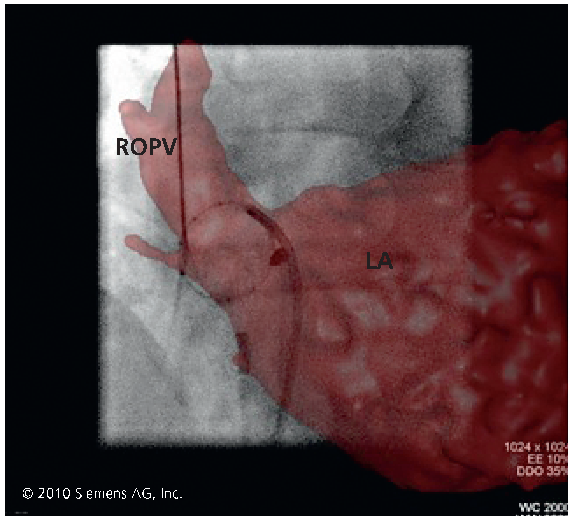 Cardiovascmed 13 00272 g008 Cardiovascmed 13 00272 g008