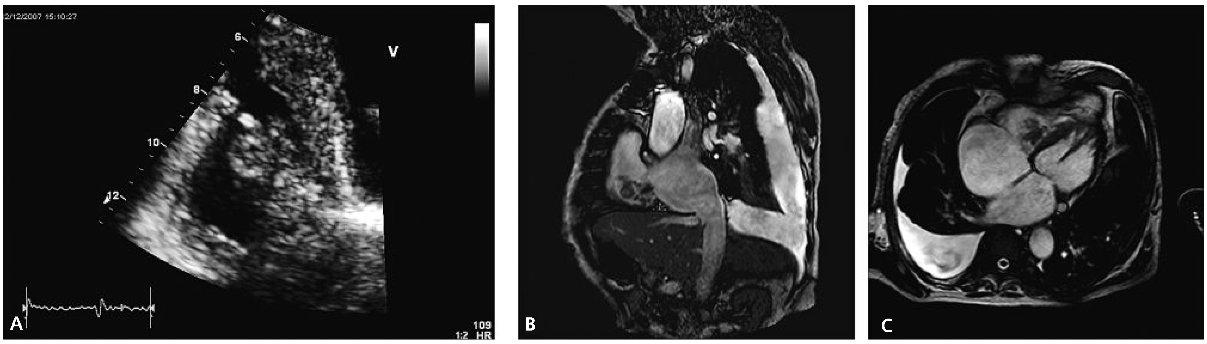 Cardiovascmed 13 00281 g001