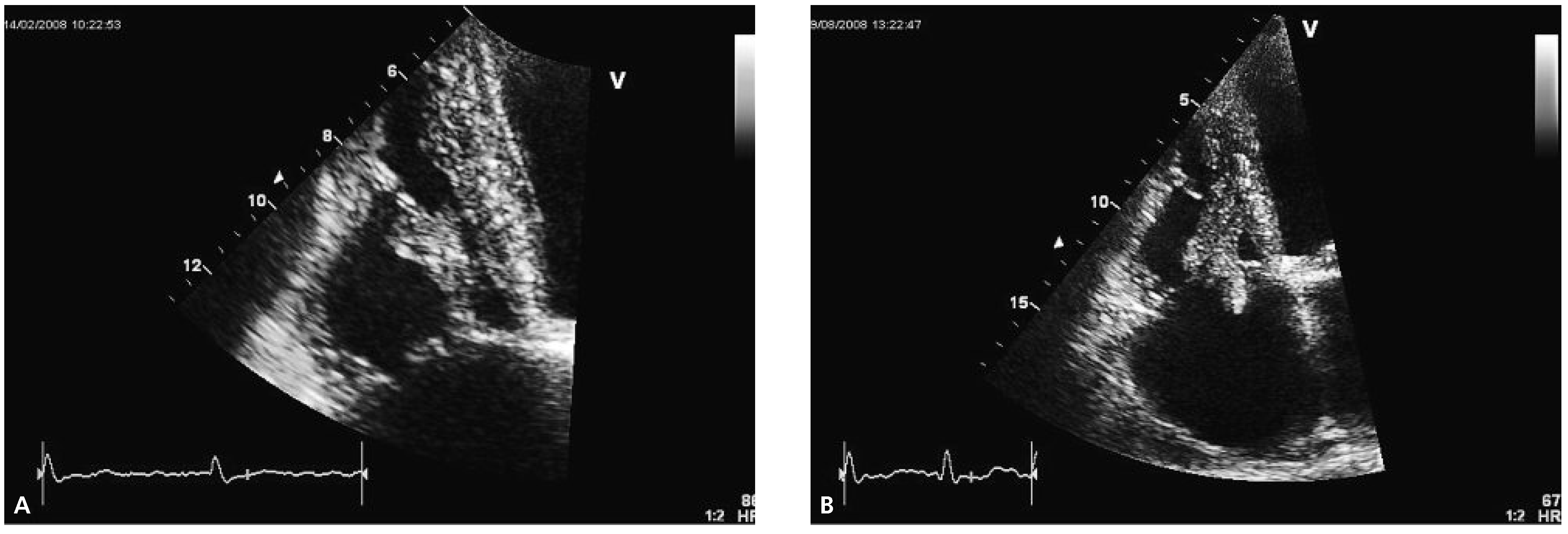 Cardiovascmed 13 00281 g002