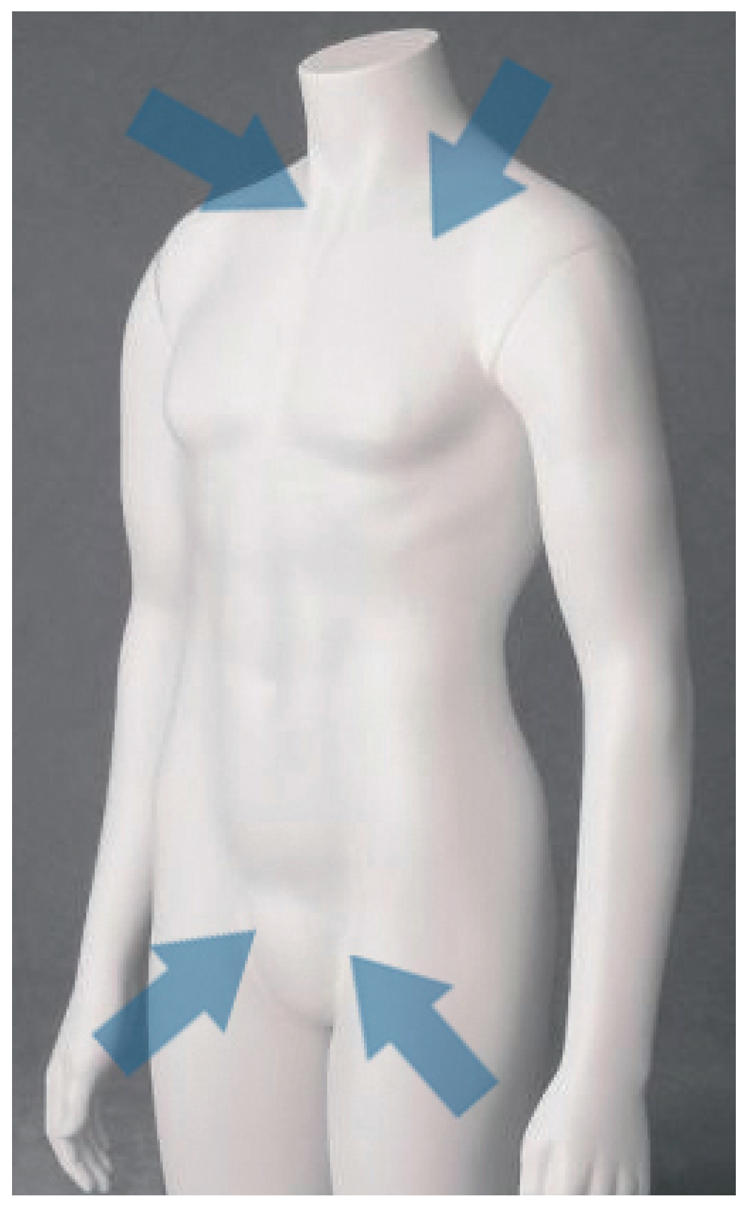 Cardiovascmed 13 00284 g001 Cardiovascmed 13 00284 g001