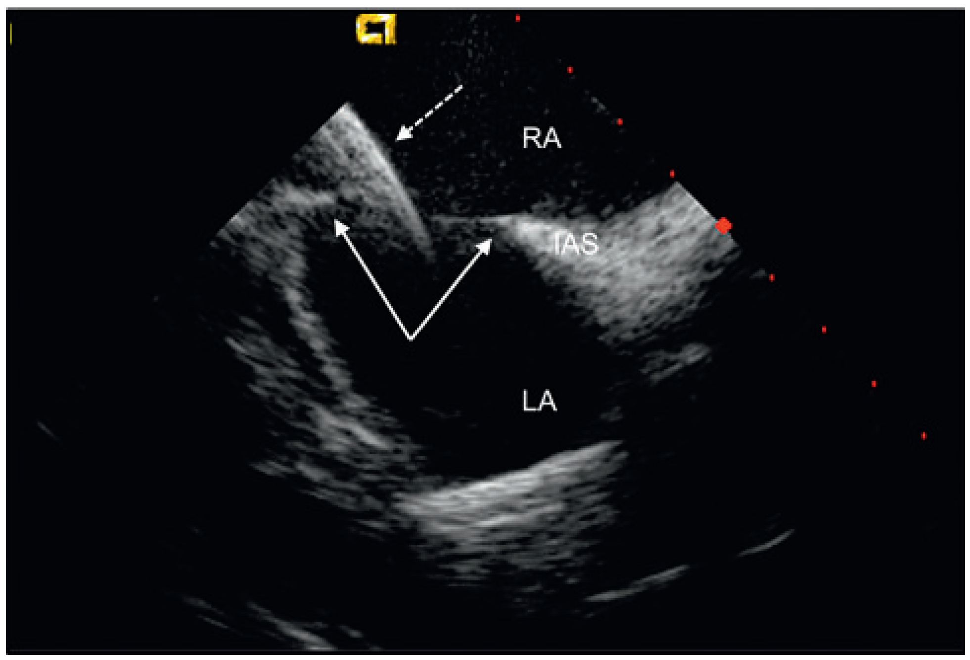 Cardiovascmed 13 00290 g001 Cardiovascmed 13 00290 g001