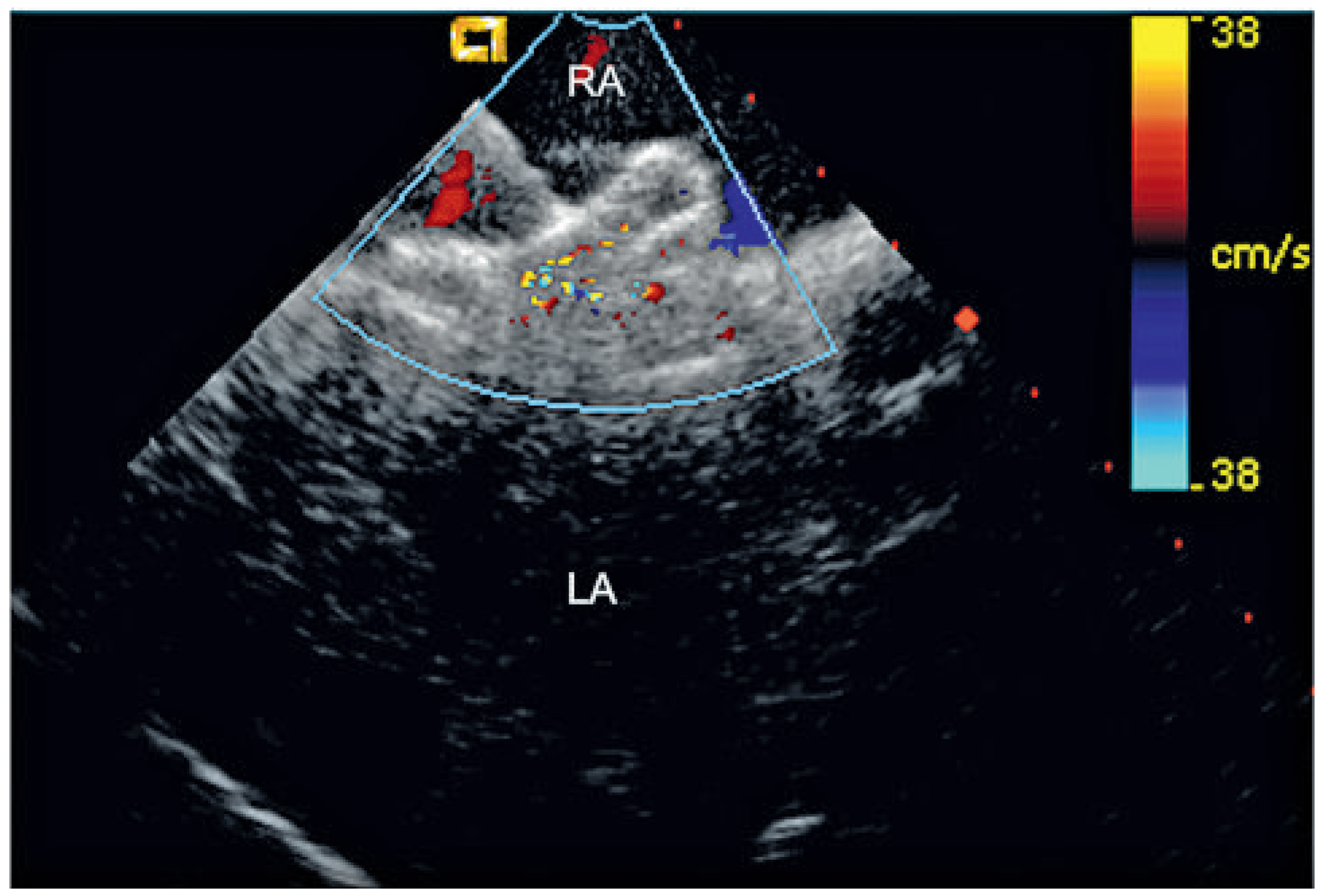 Cardiovascmed 13 00290 g003 Cardiovascmed 13 00290 g003