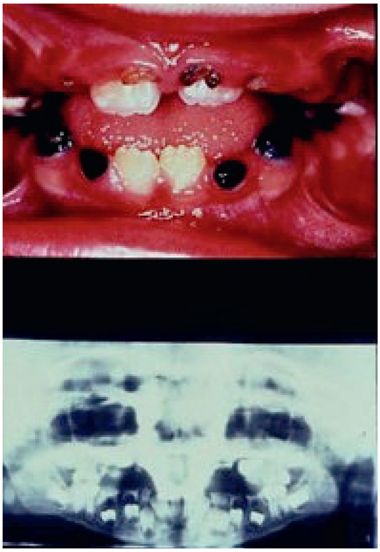 Cardiovascmed 13 00297 g005 Cardiovascmed 13 00297 g005