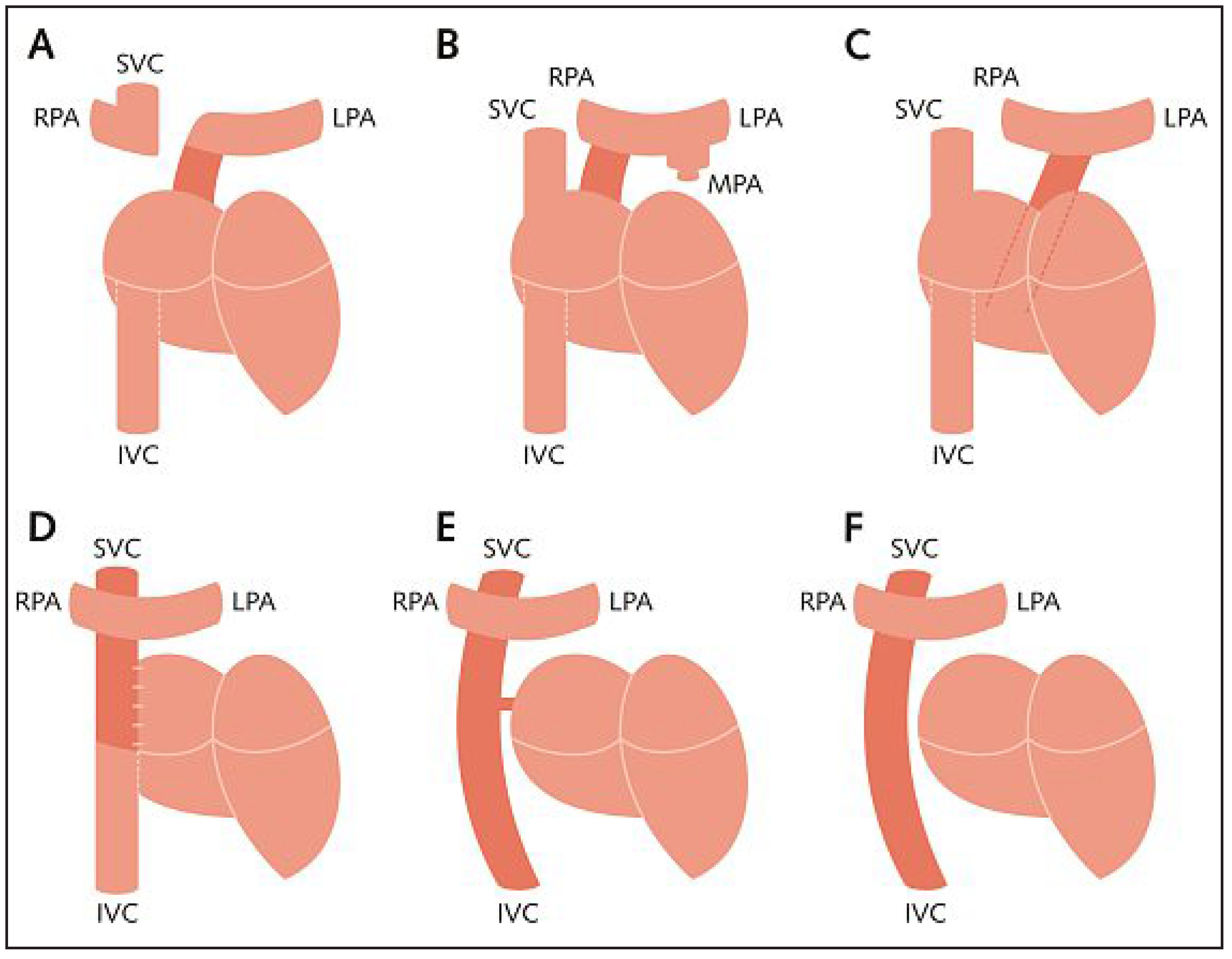 Cardiovascmed 13 00309 g001