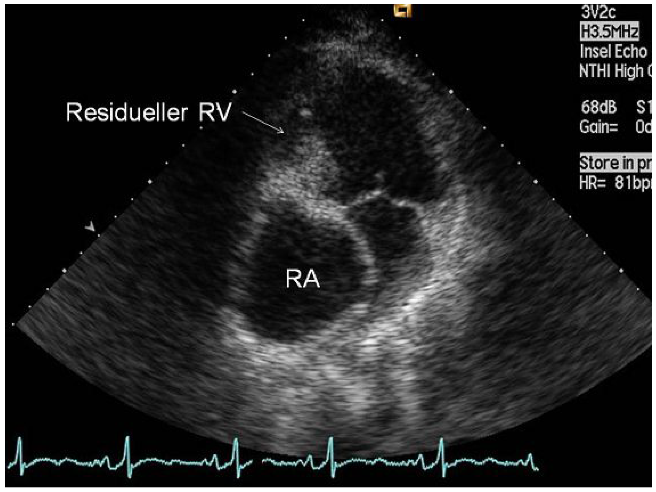 Cardiovascmed 13 00309 g002