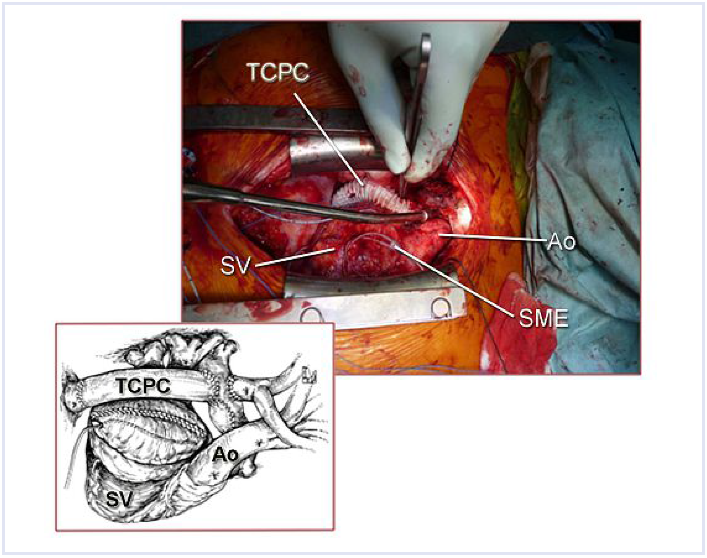 Cardiovascmed 13 00309 g004