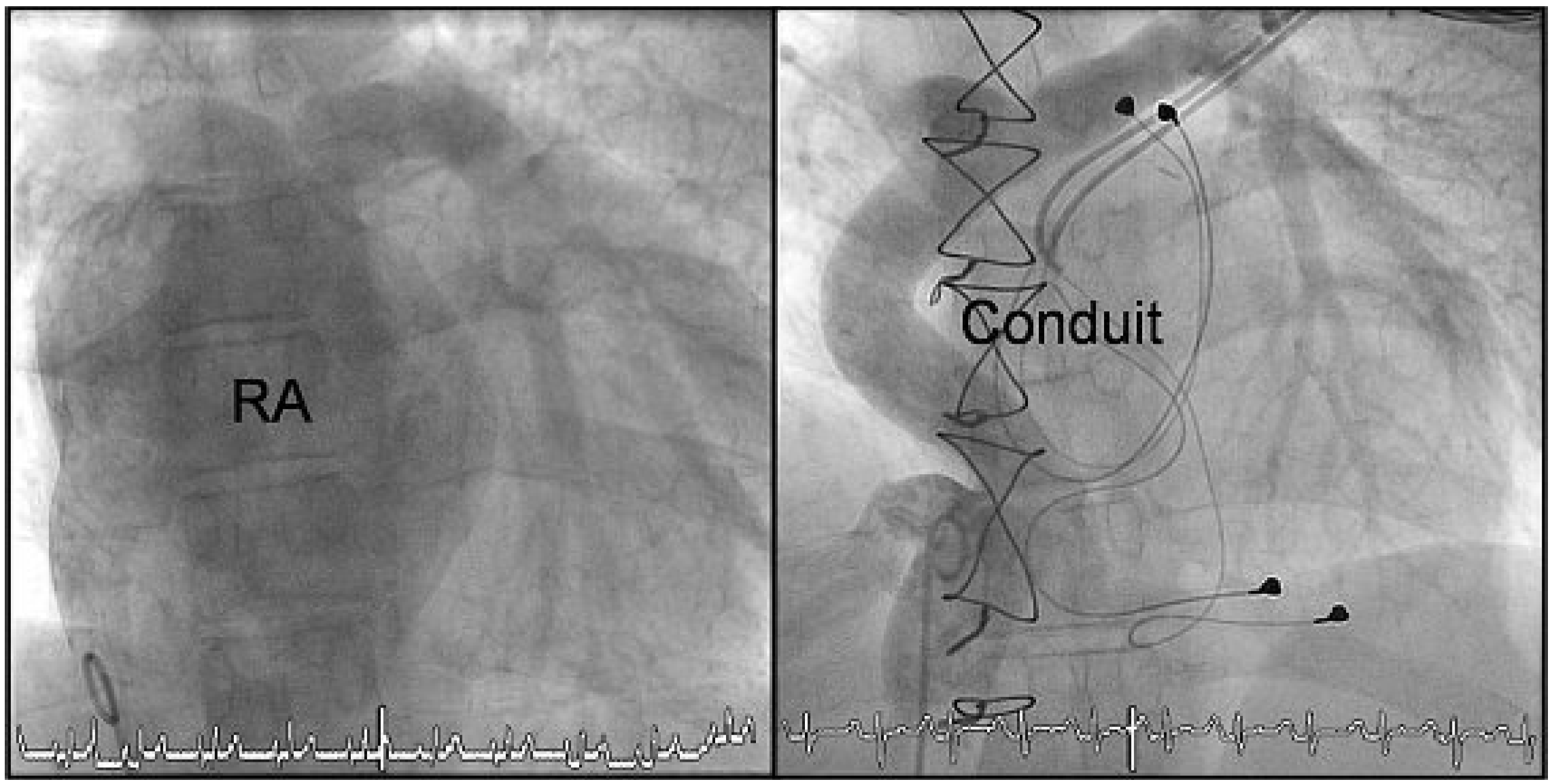 Cardiovascmed 13 00309 g005