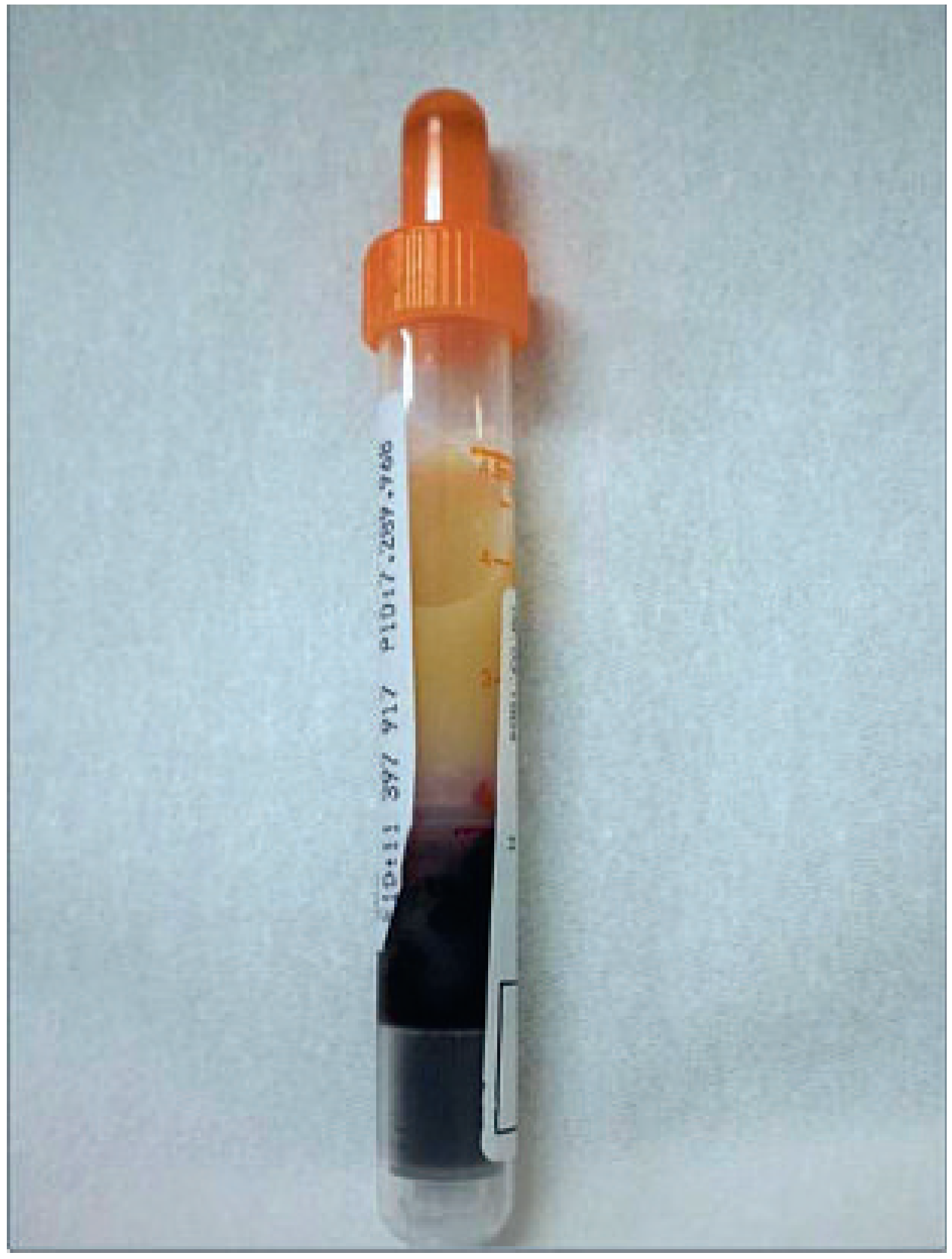 Cardiovascmed 13 00317 g001