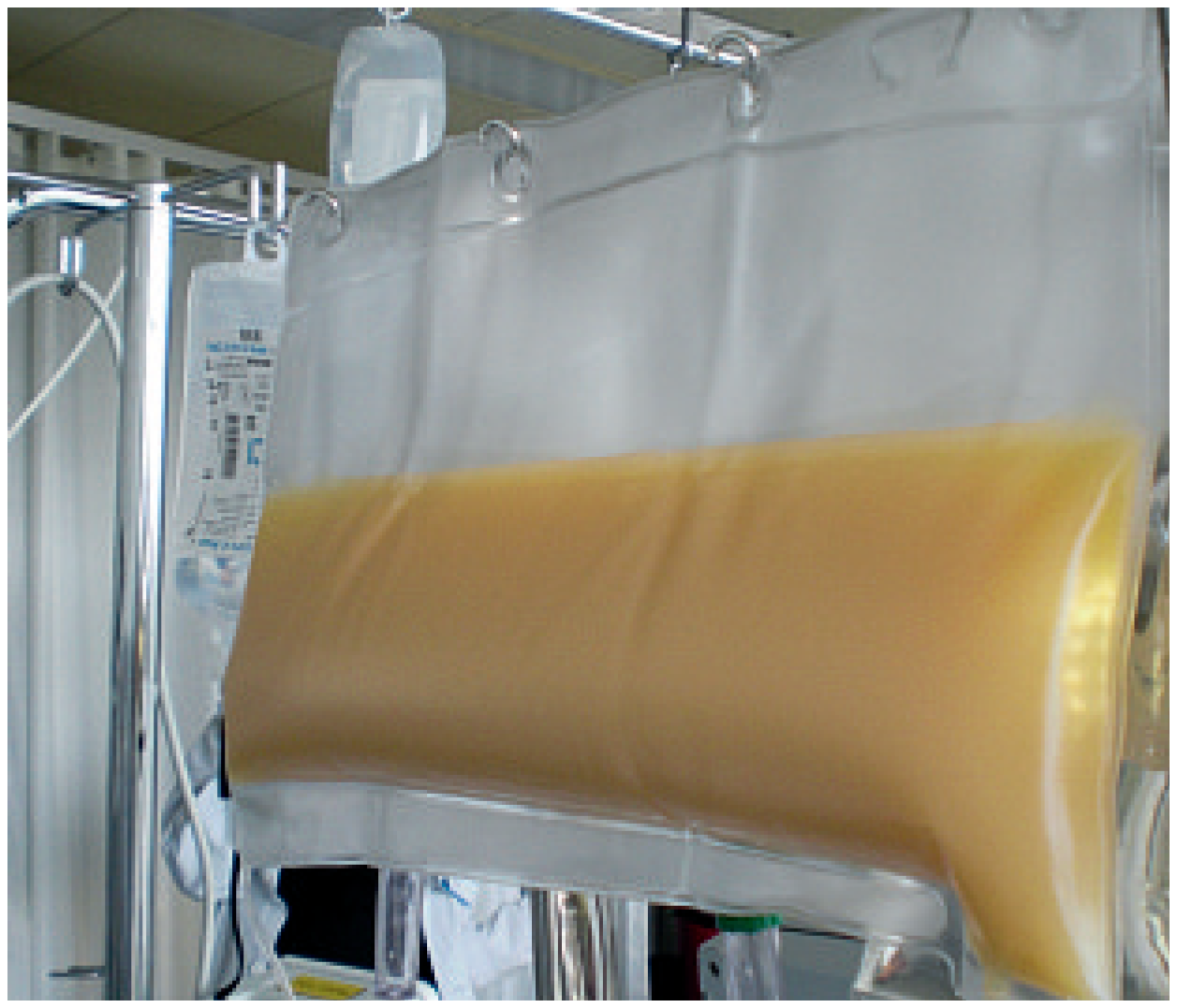 Cardiovascmed 13 00317 g002