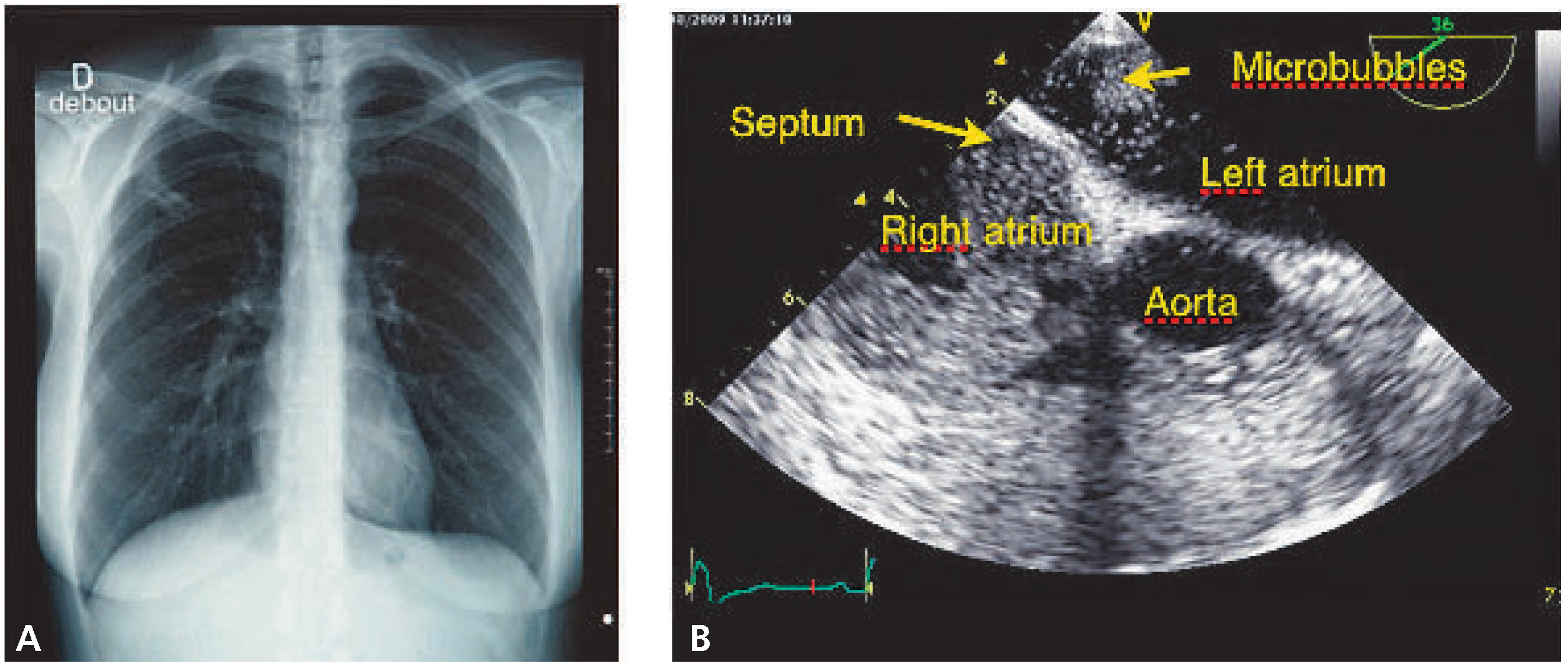 Cardiovascmed 13 00318 g001 Cardiovascmed 13 00318 g001