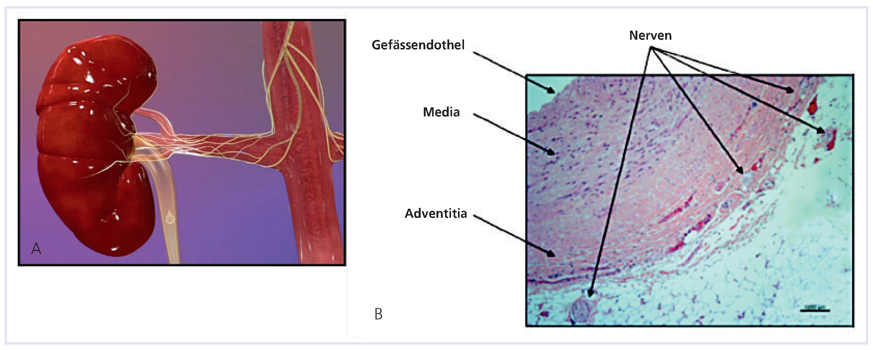 Cardiovascmed 13 00321 g006
