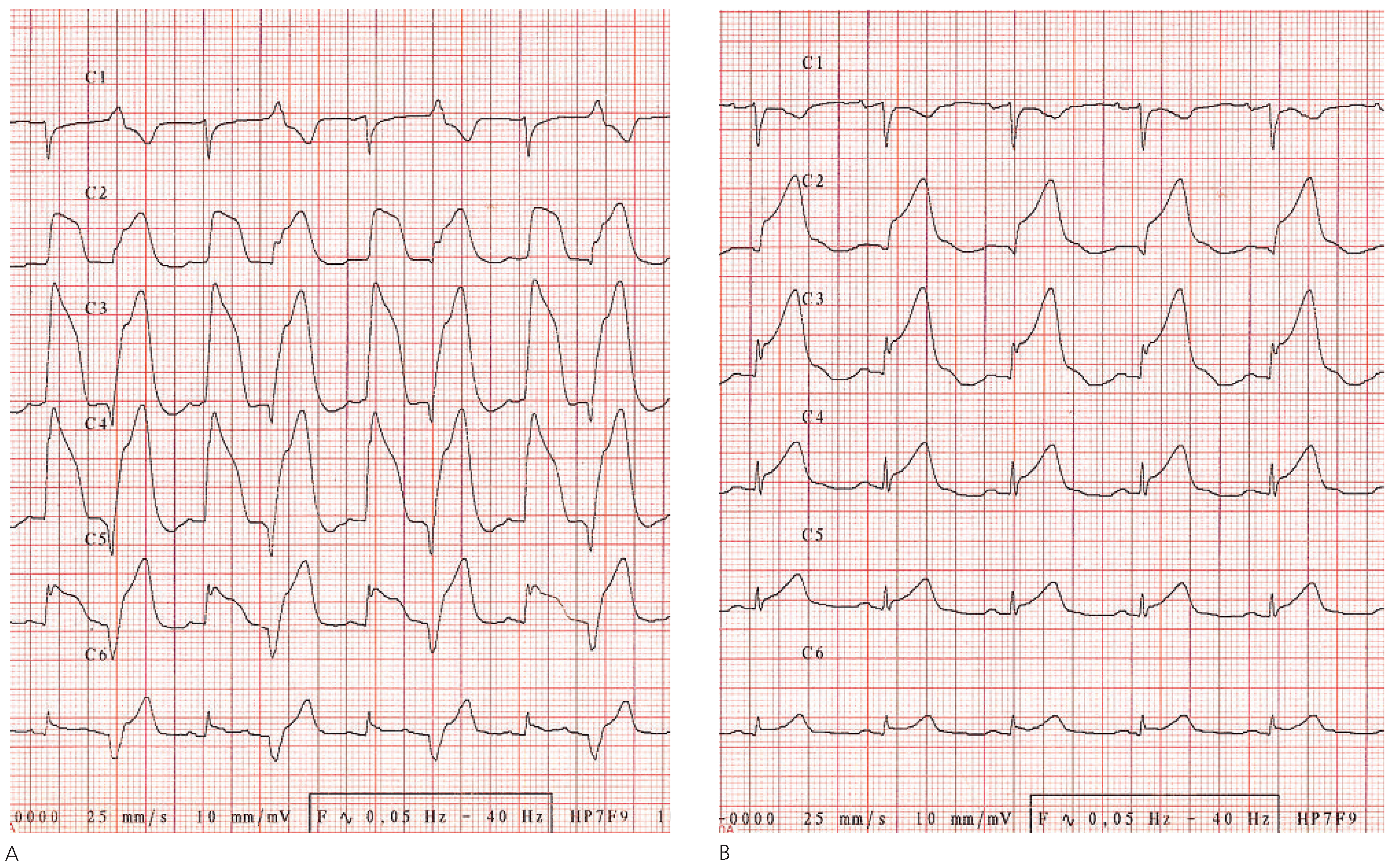 Cardiovascmed 13 00326 g001
