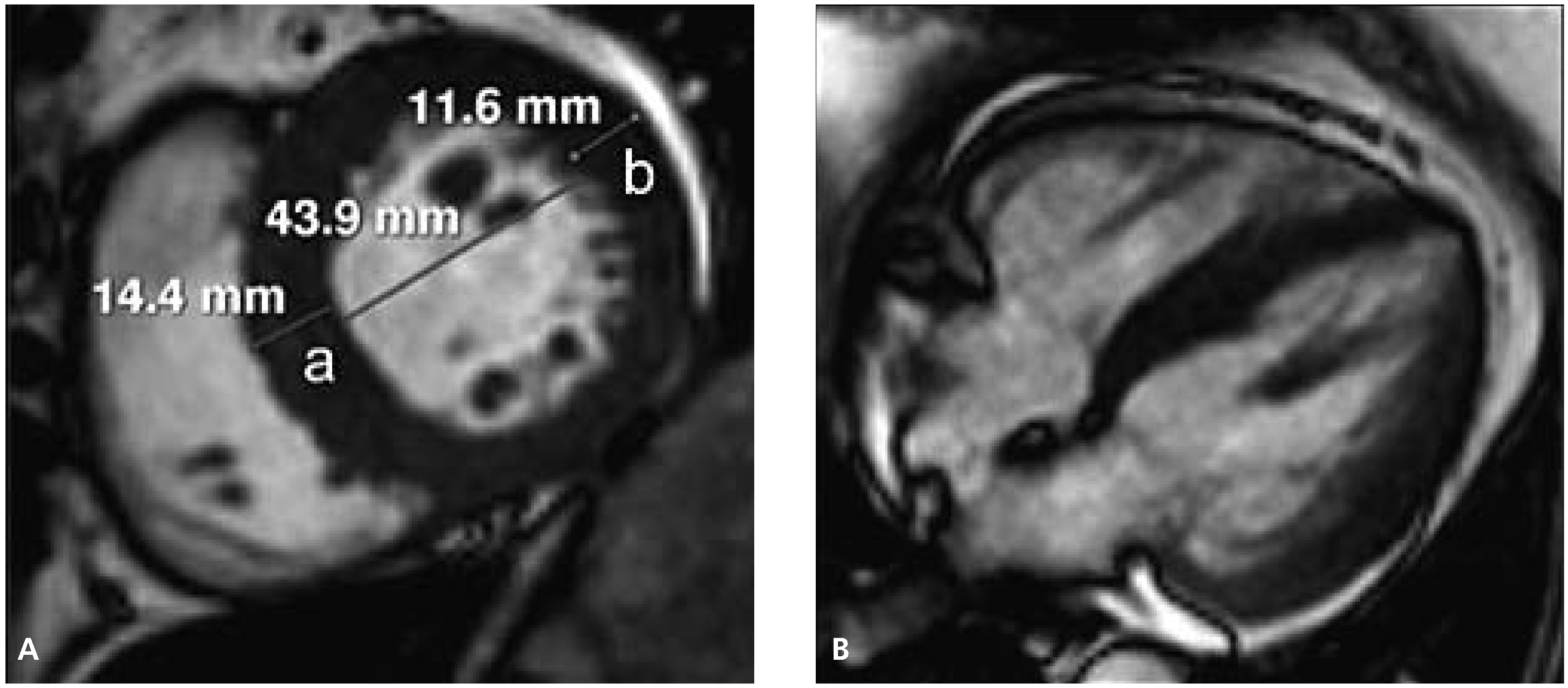 Cardiovascmed 13 00346 g001