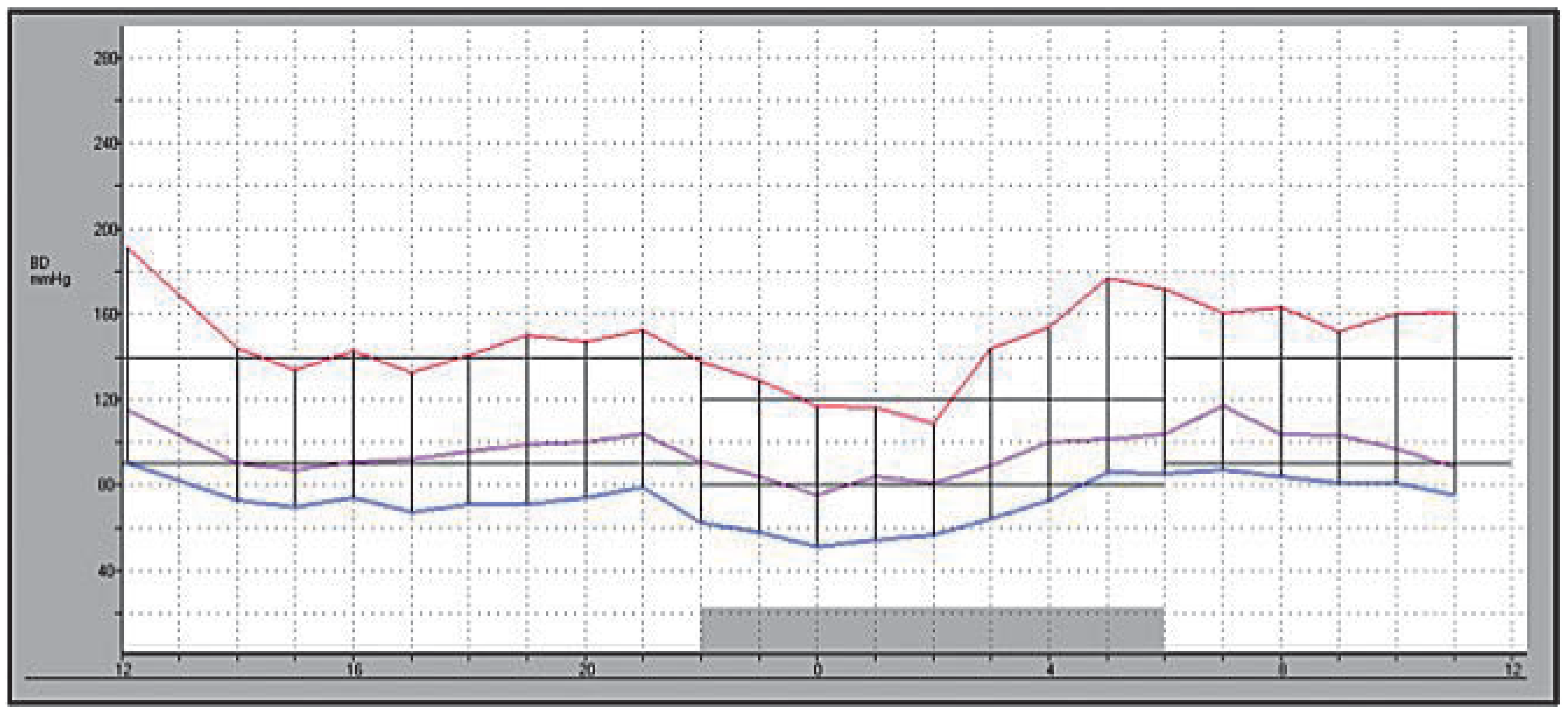 Cardiovascmed 13 00346 g002